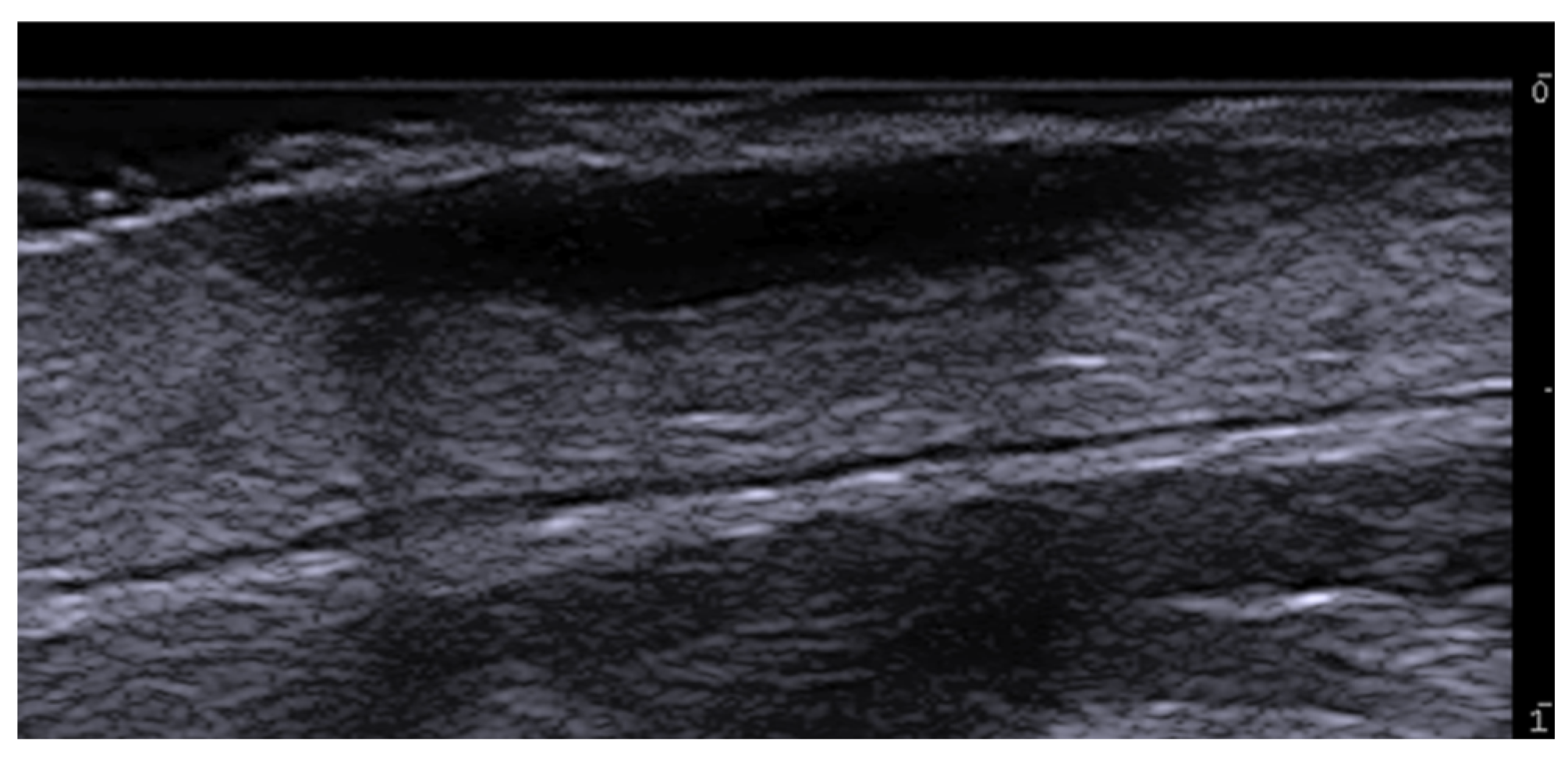 Medicina 61 00220 g005