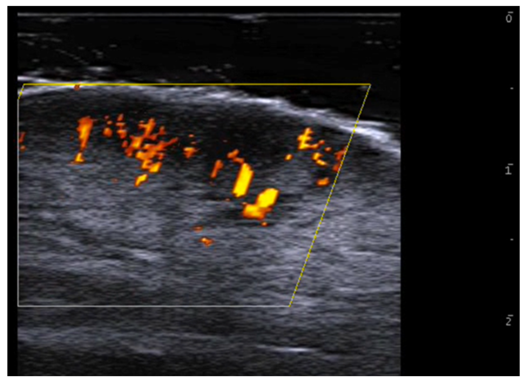 Medicina 61 00220 g006