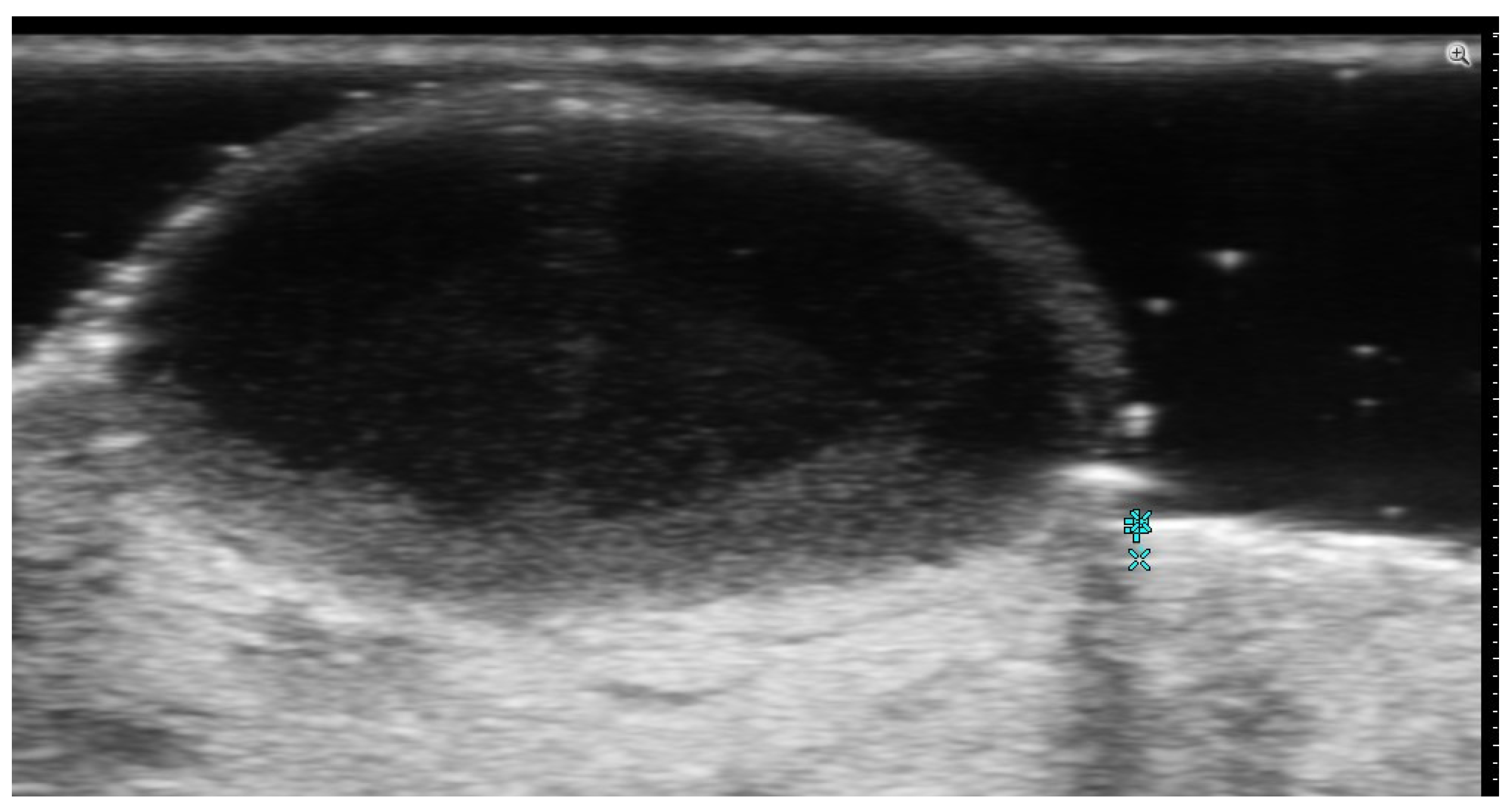 Medicina 61 00220 g010