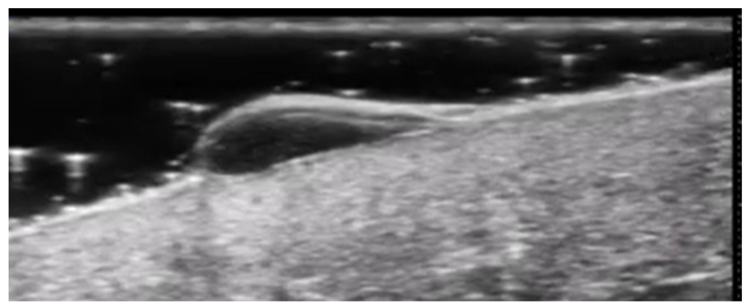 Medicina 61 00220 g011