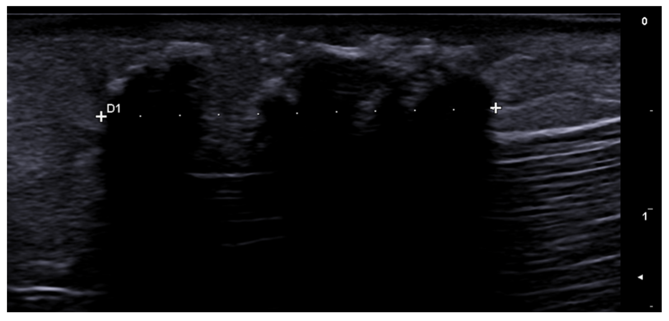 Medicina 61 00220 g013