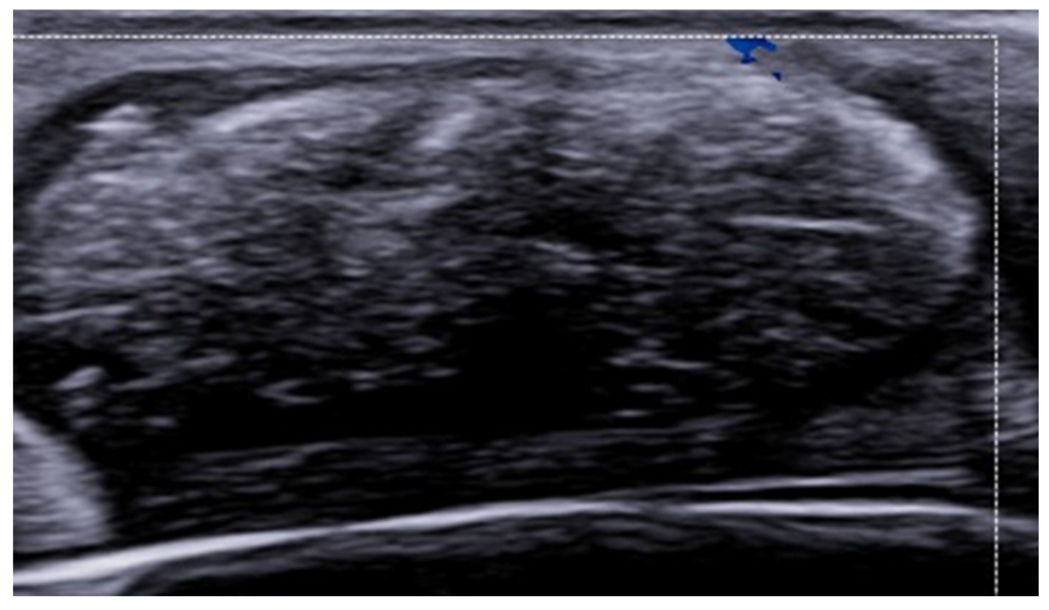 Medicina 61 00220 g015