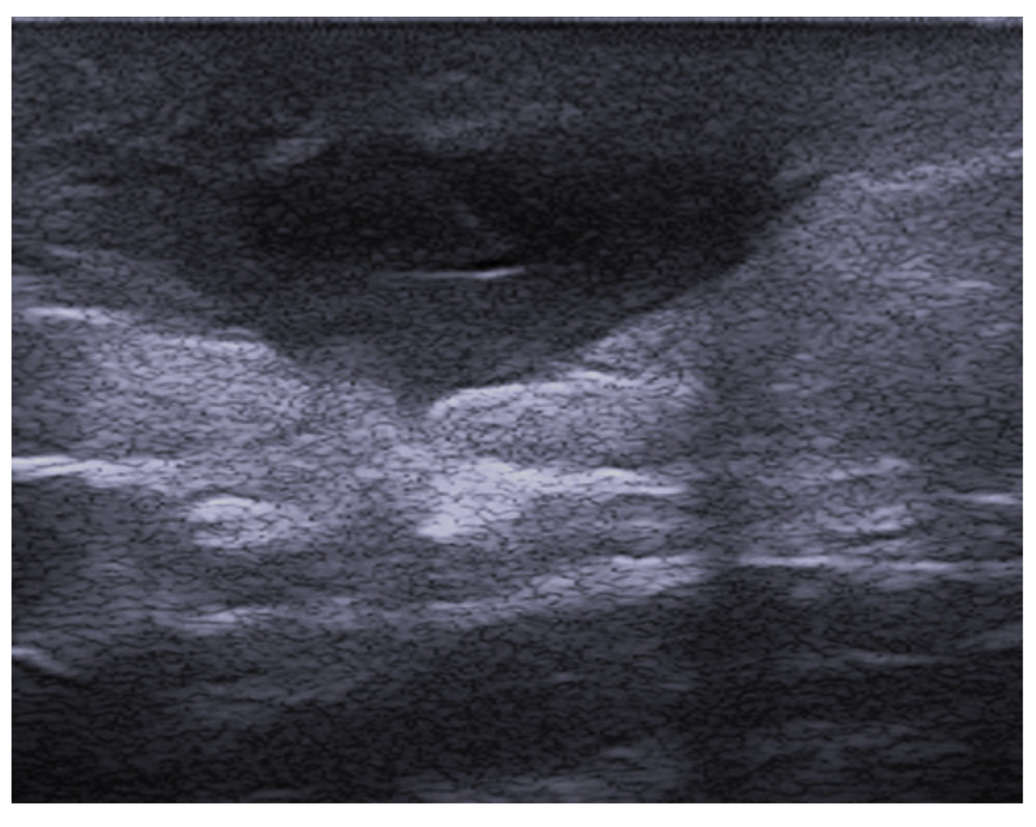 Medicina 61 00220 g021