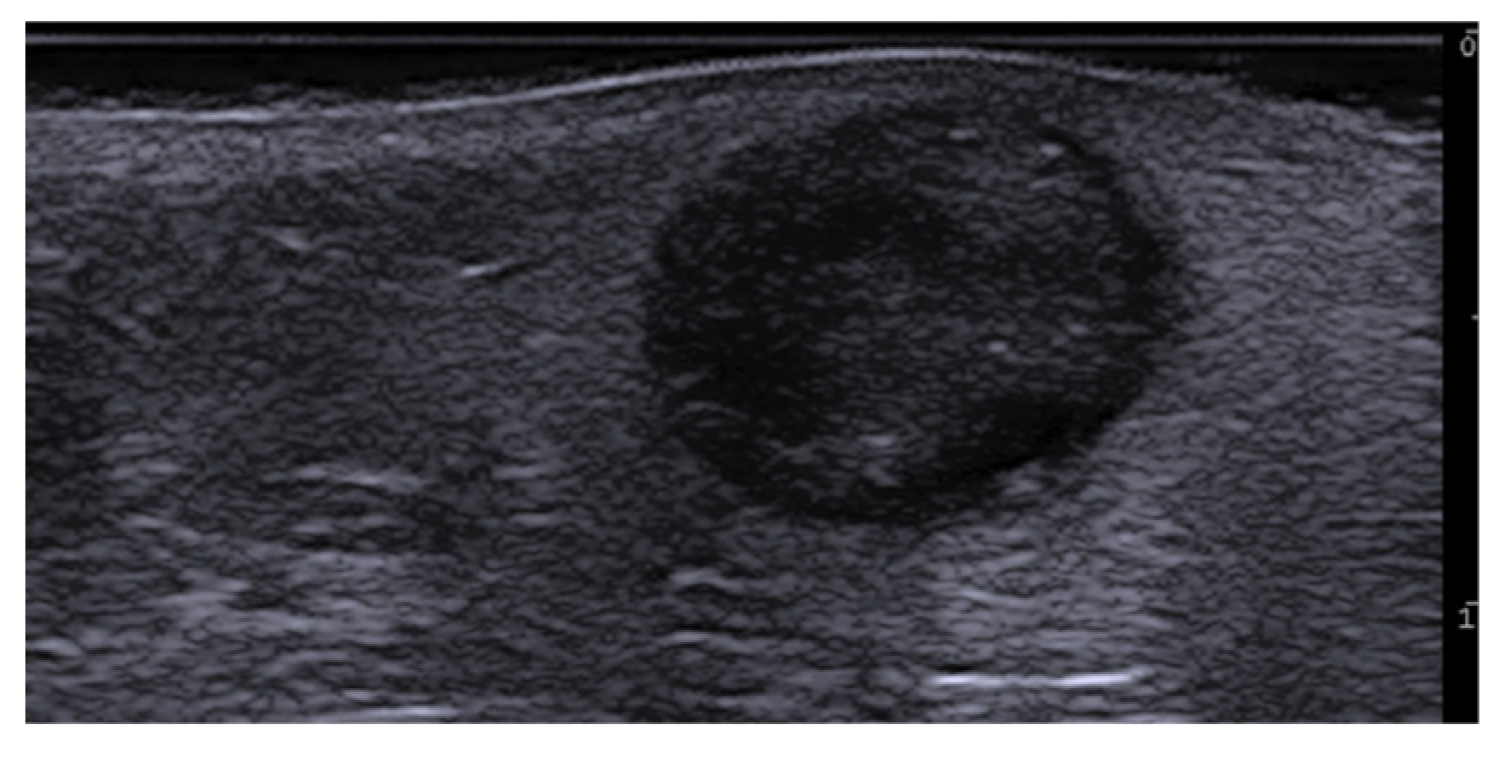 Medicina 61 00220 g039