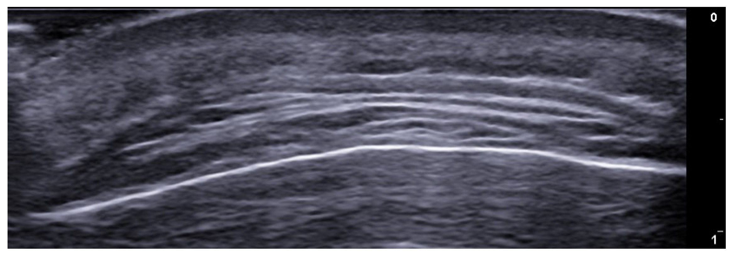 Medicina 61 00220 g043