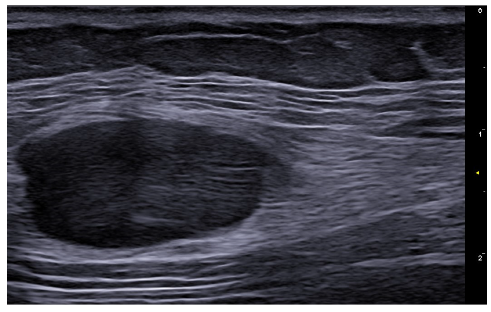 Medicina 61 00220 g044