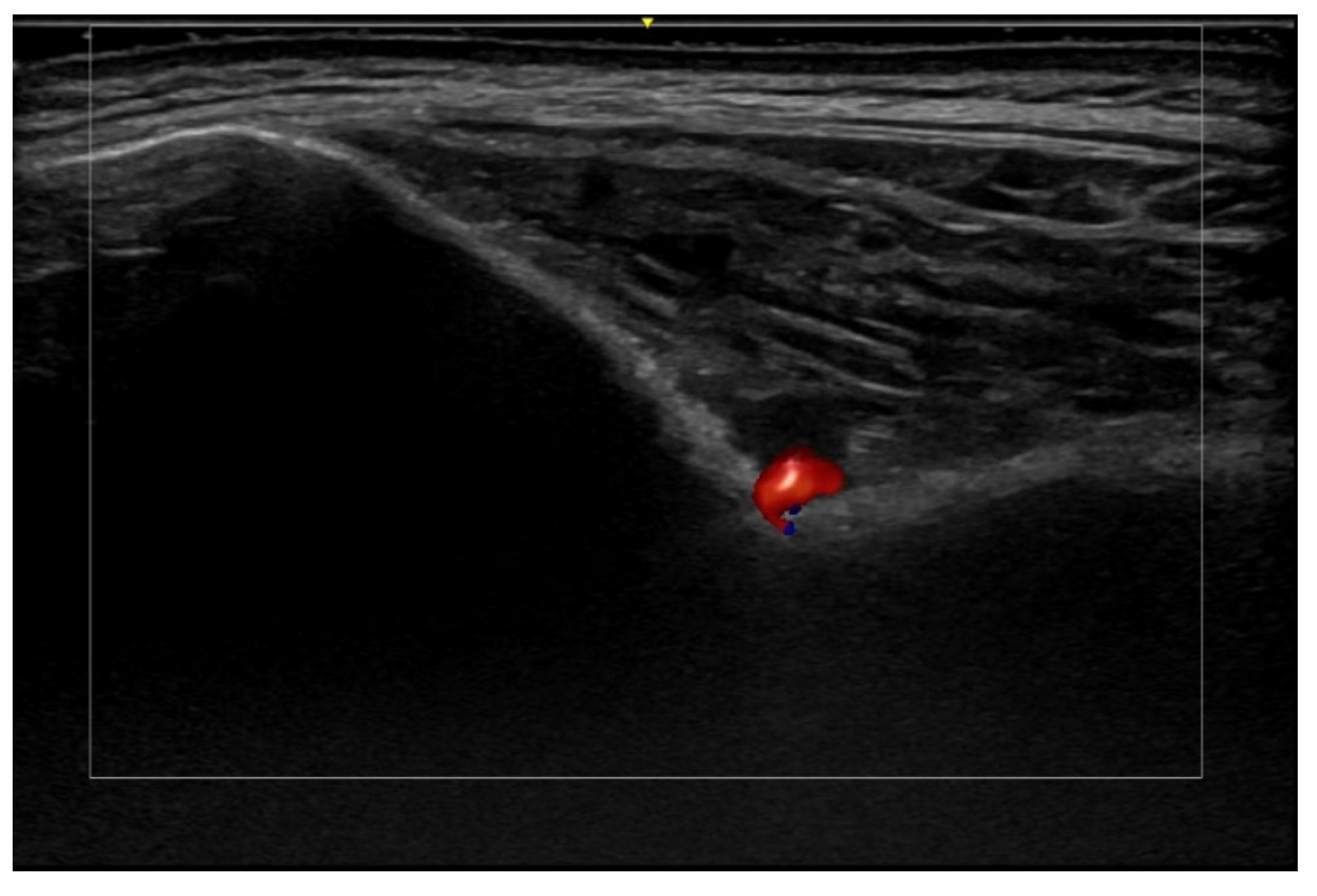 Medicina 61 00220 g056