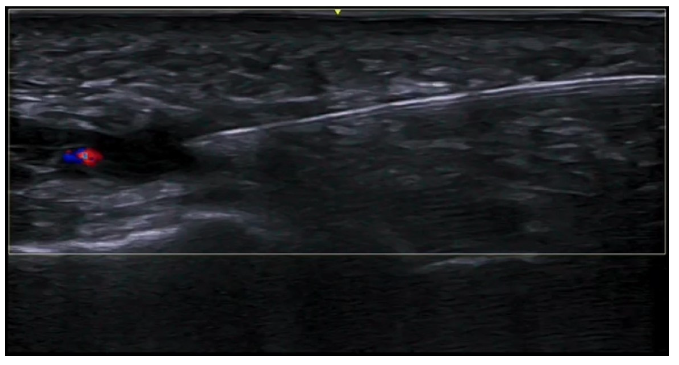 Medicina 61 00220 g058