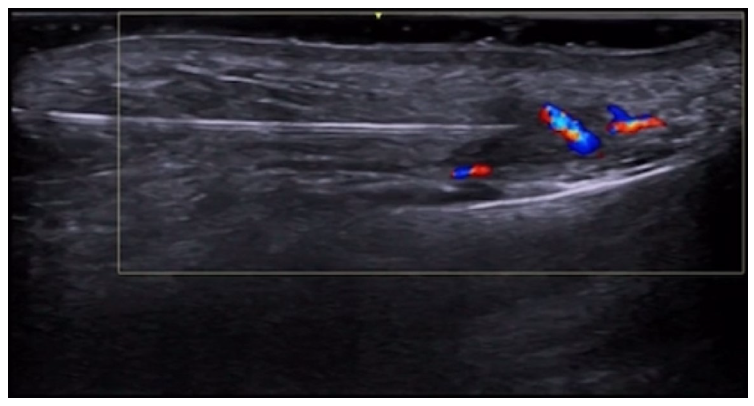 Medicina 61 00220 g059