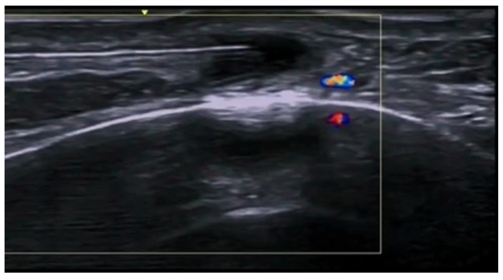 Medicina 61 00220 g060