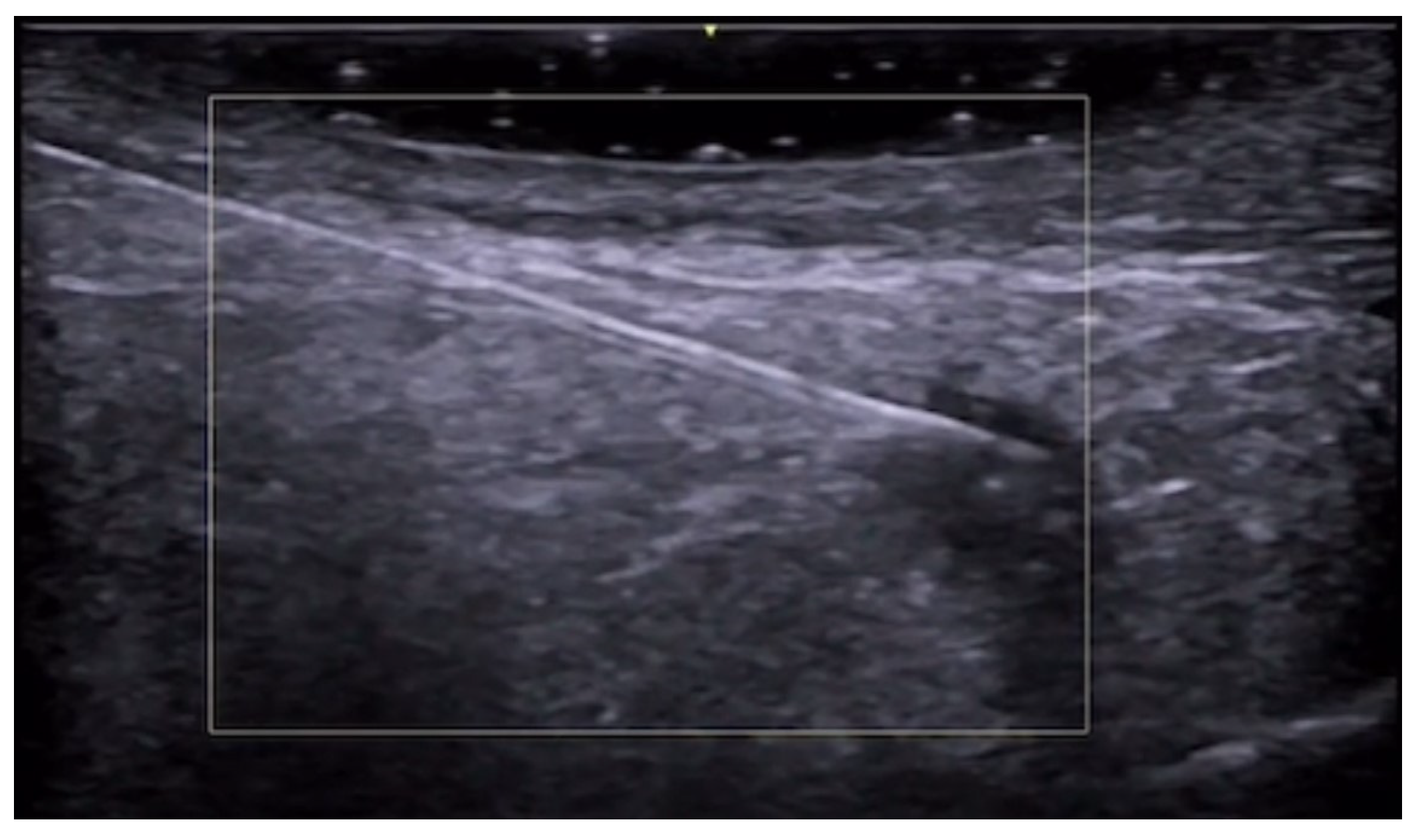 Medicina 61 00220 g061