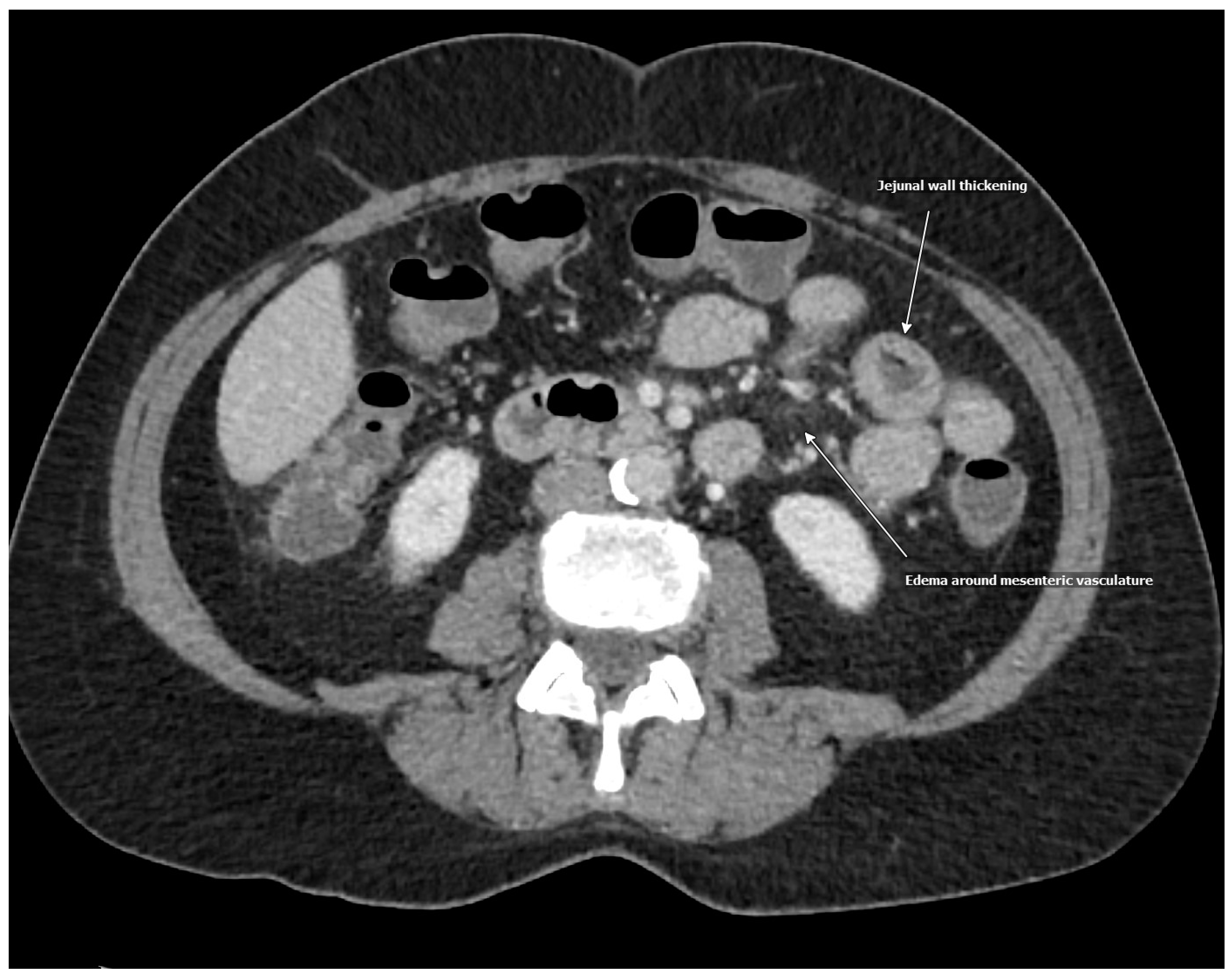 Medicina 61 00245 g001