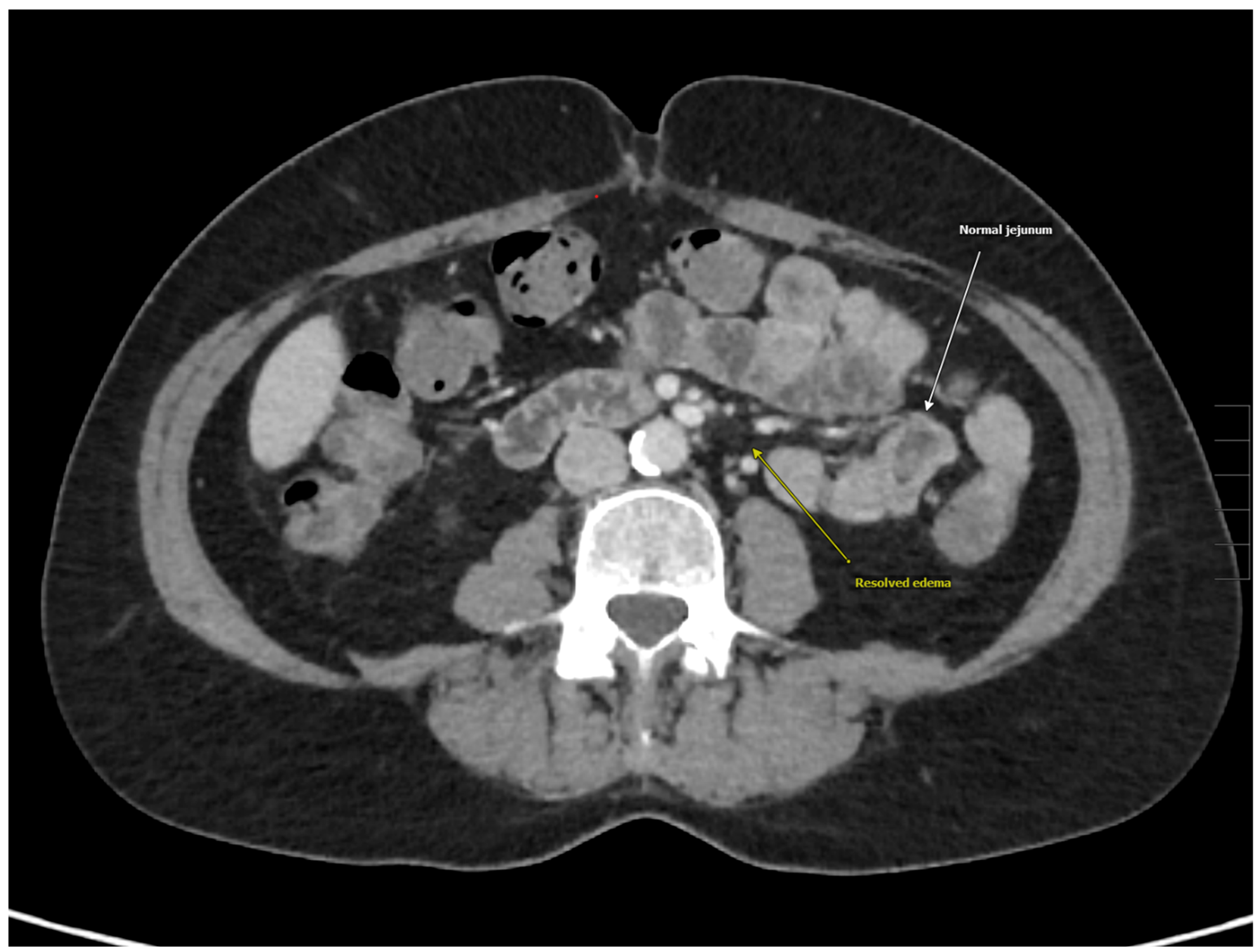 Medicina 61 00245 g003