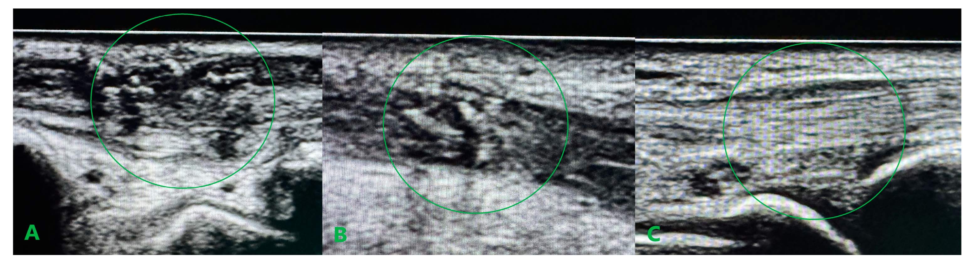 Medicina 61 00249 g005