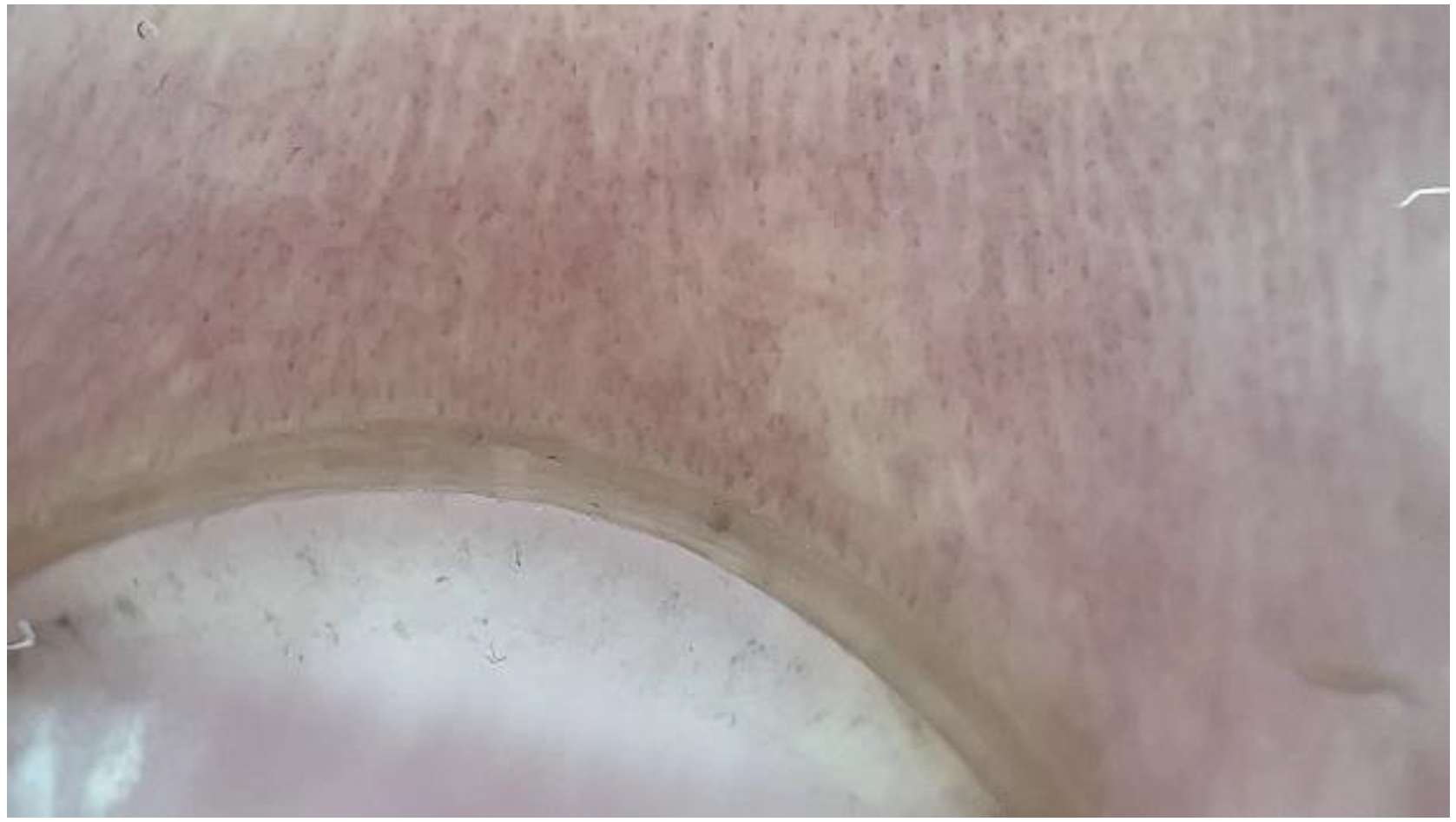 Medicina 61 00264 g004