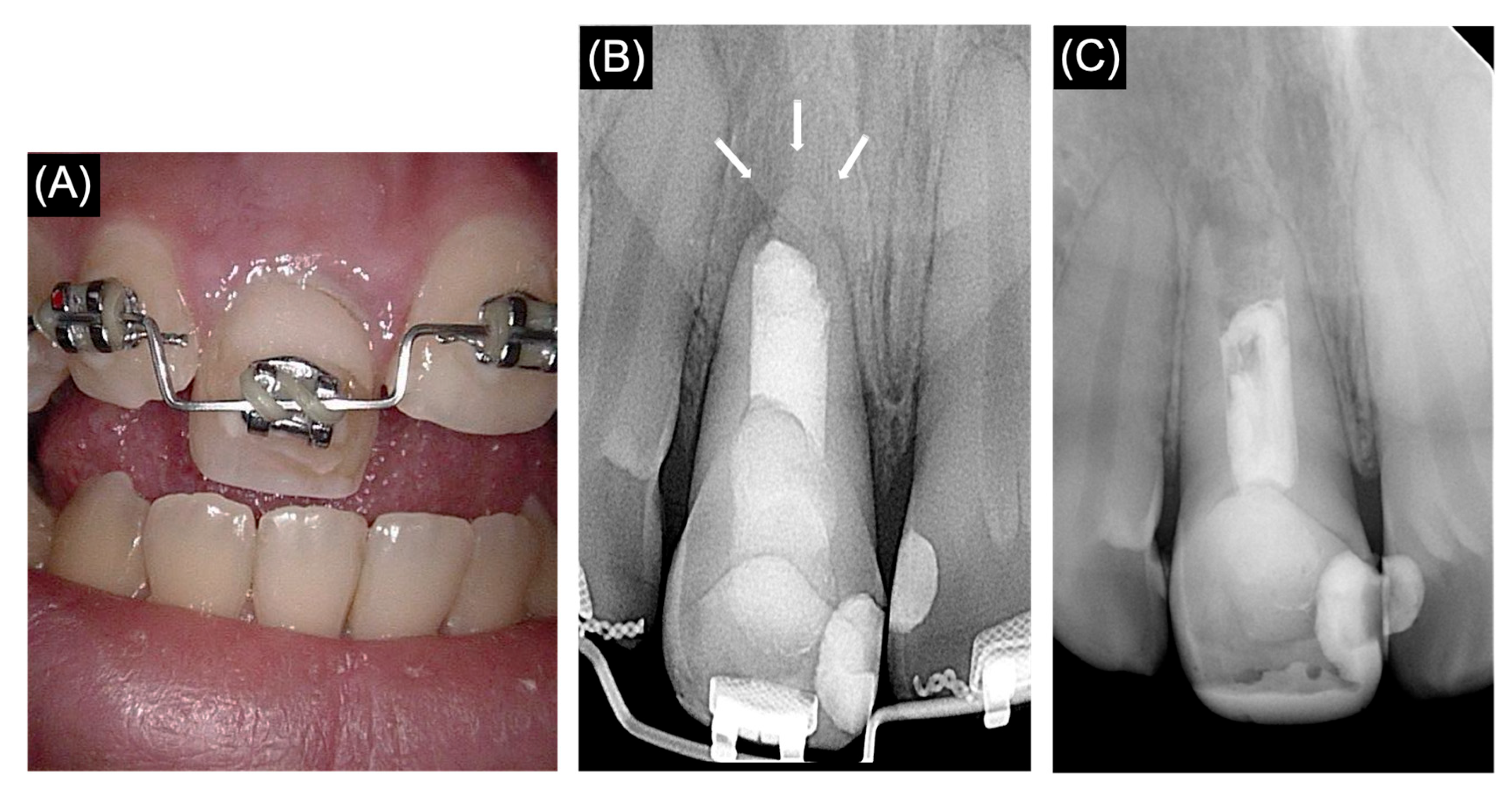 Medicina 61 00276 g003