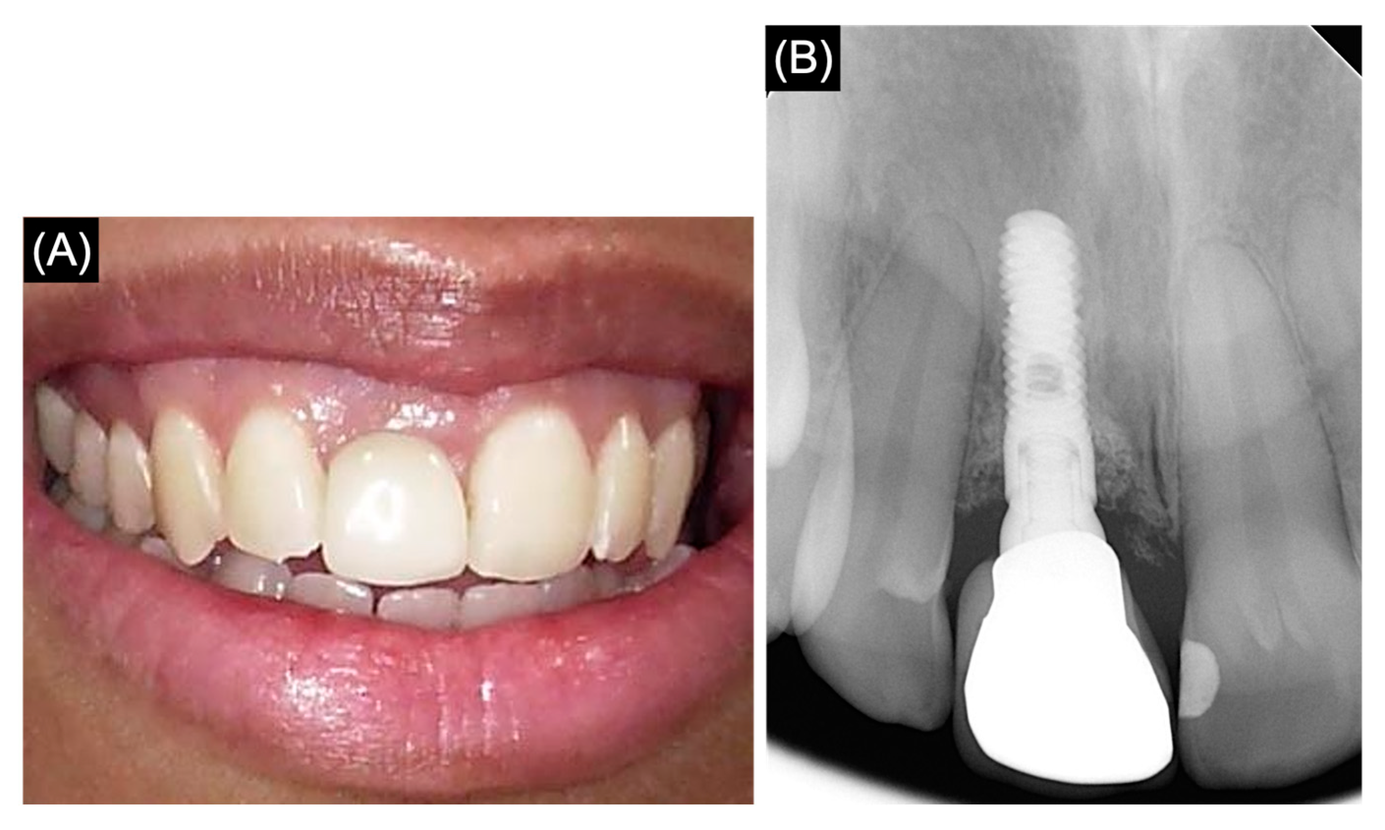 Medicina 61 00276 g004