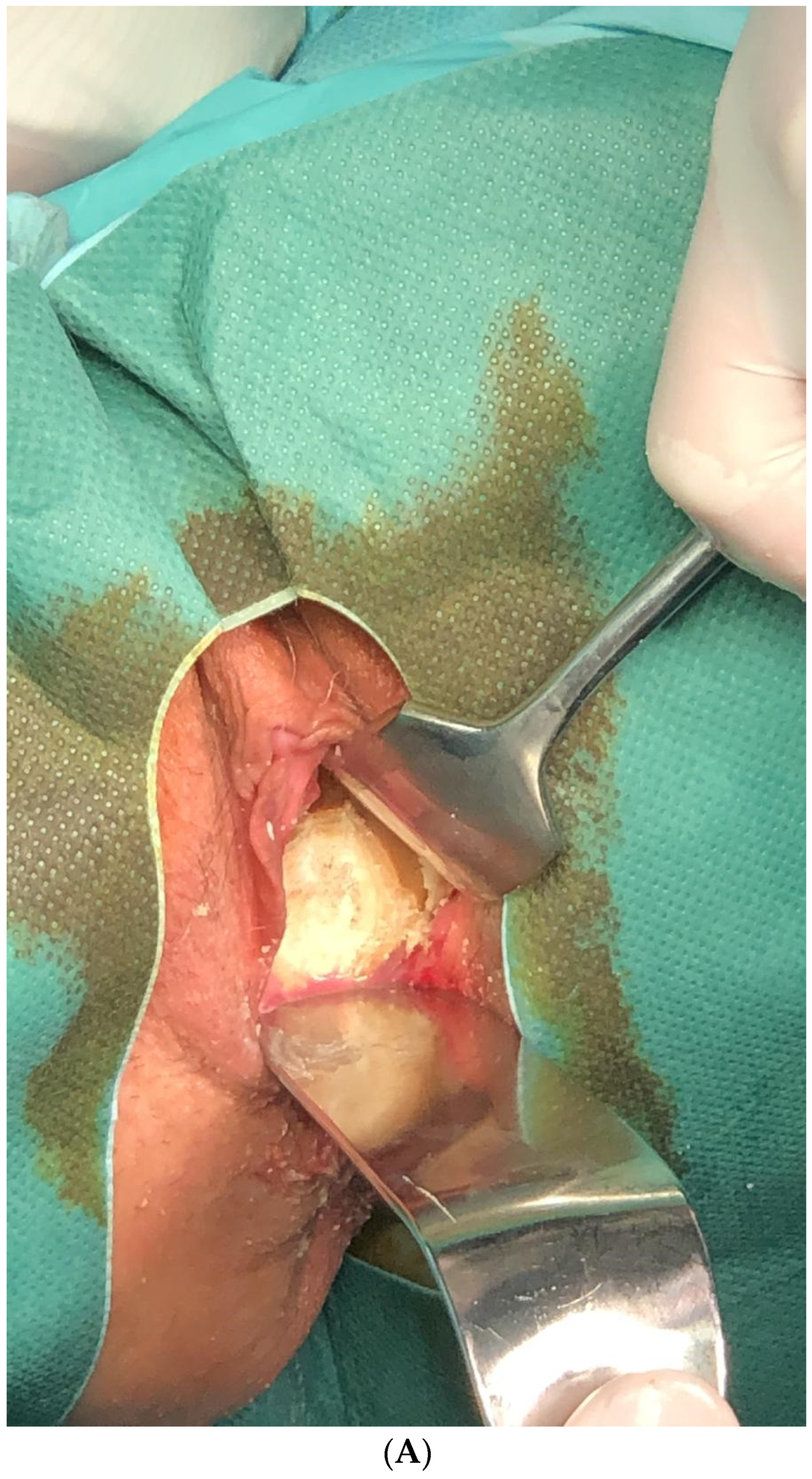 Medicina 61 00290 g001a