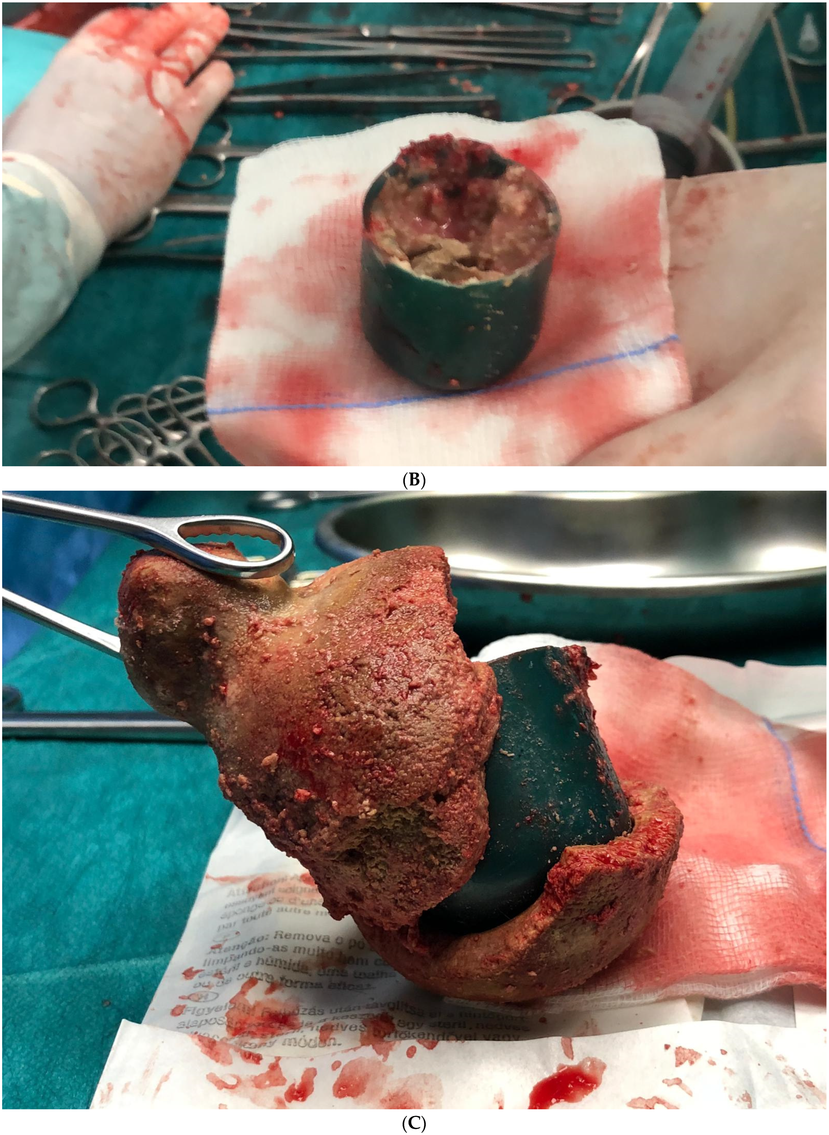 Medicina 61 00290 g001b