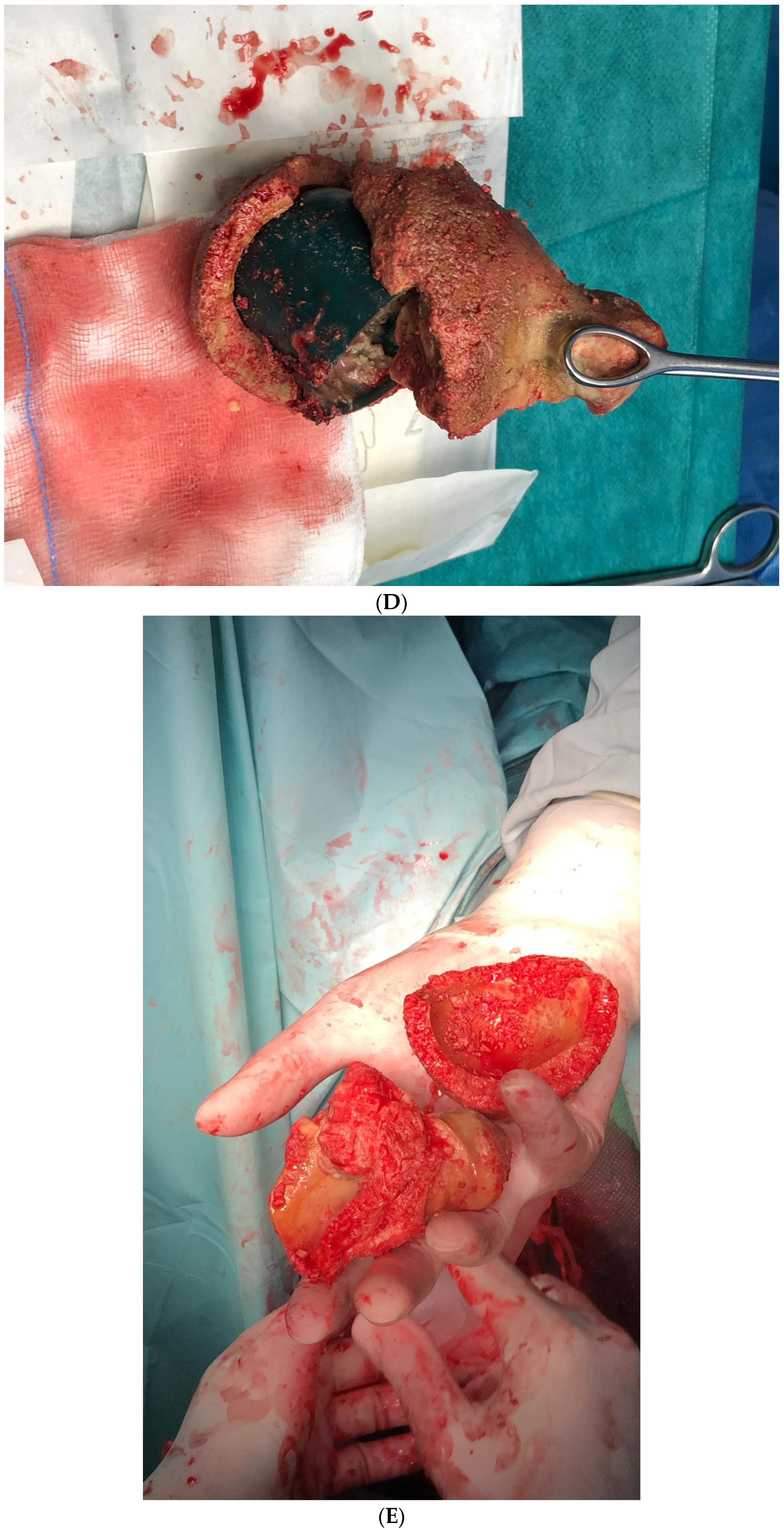 Medicina 61 00290 g001c