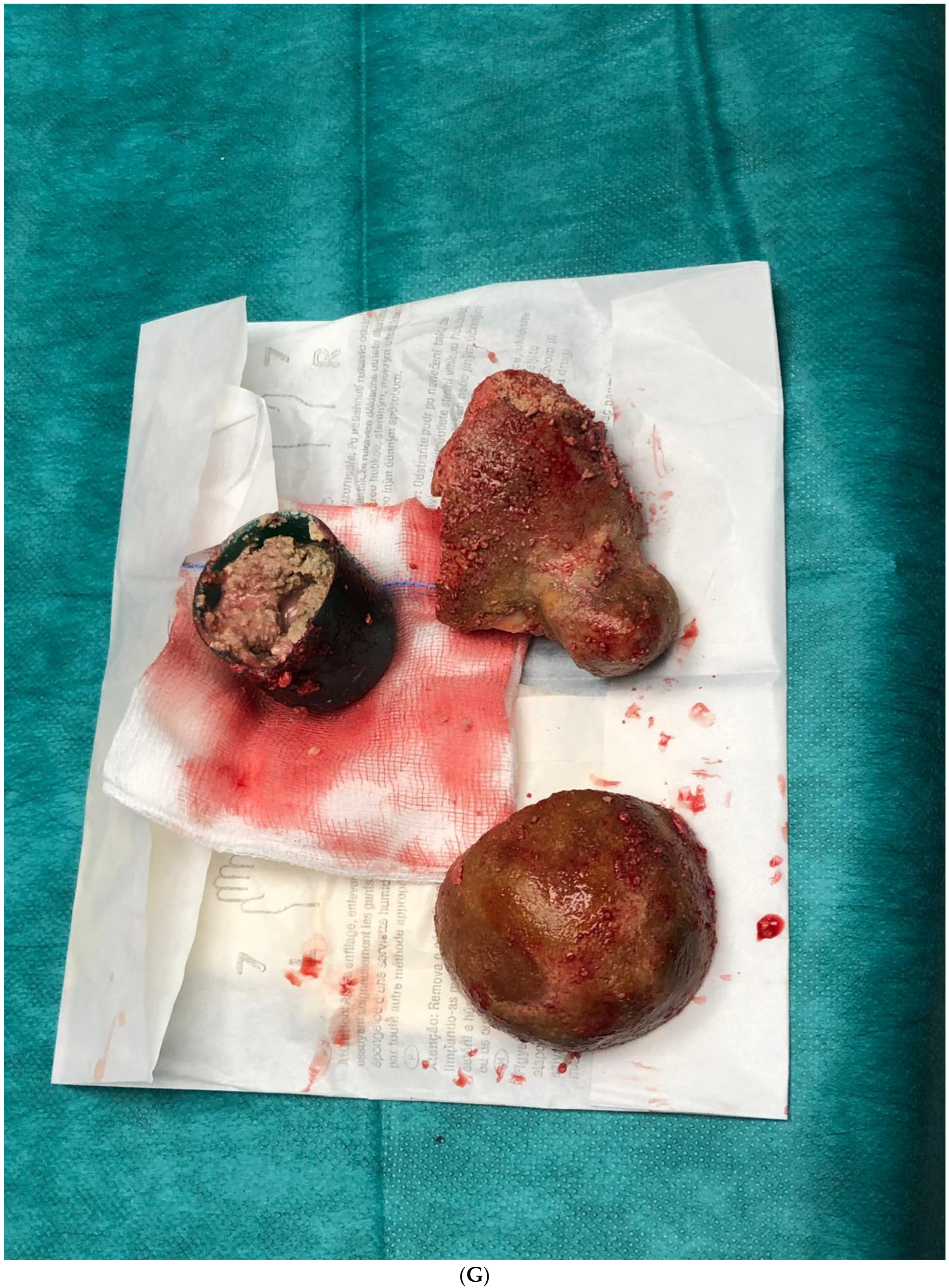 Medicina 61 00290 g001e