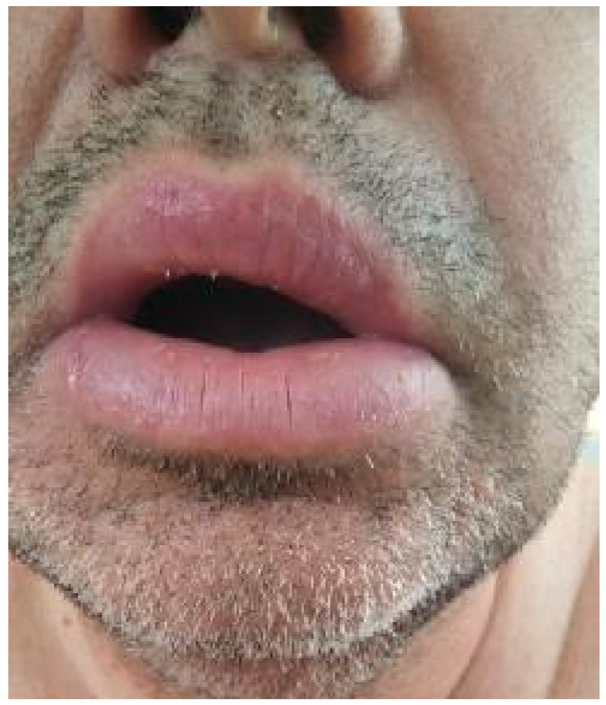 Medicina 61 00299 g001