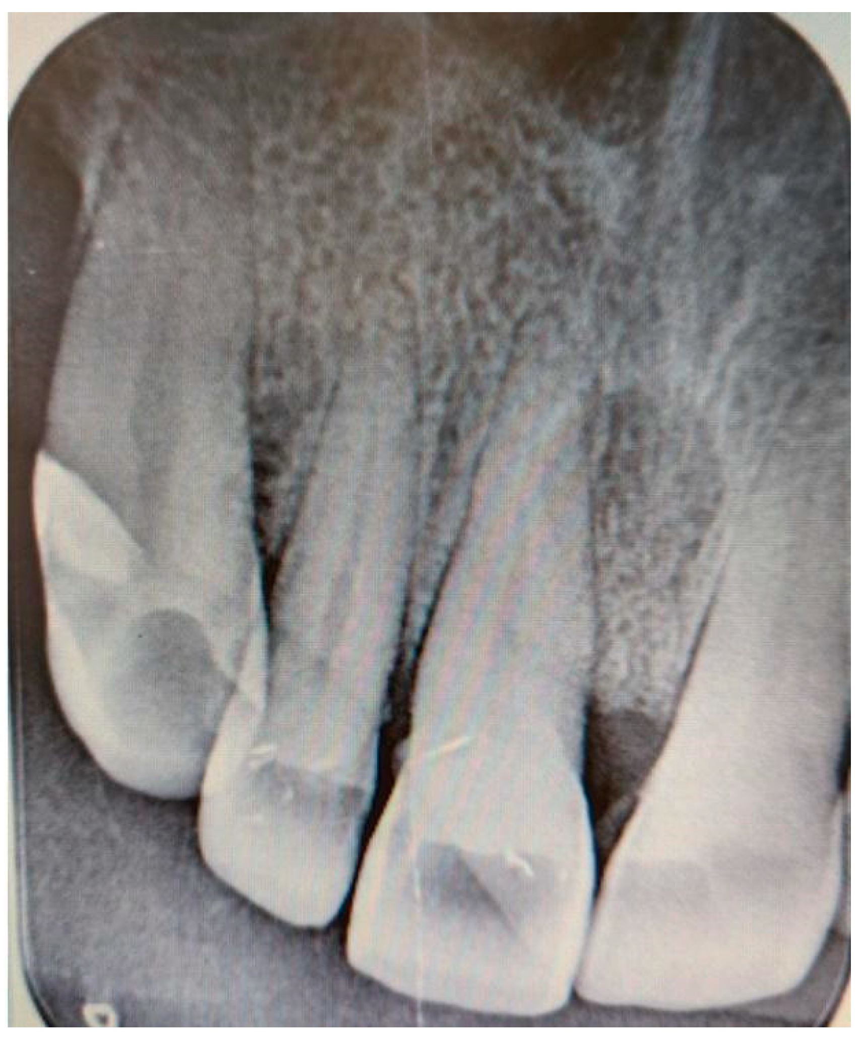 Medicina 61 00299 g003