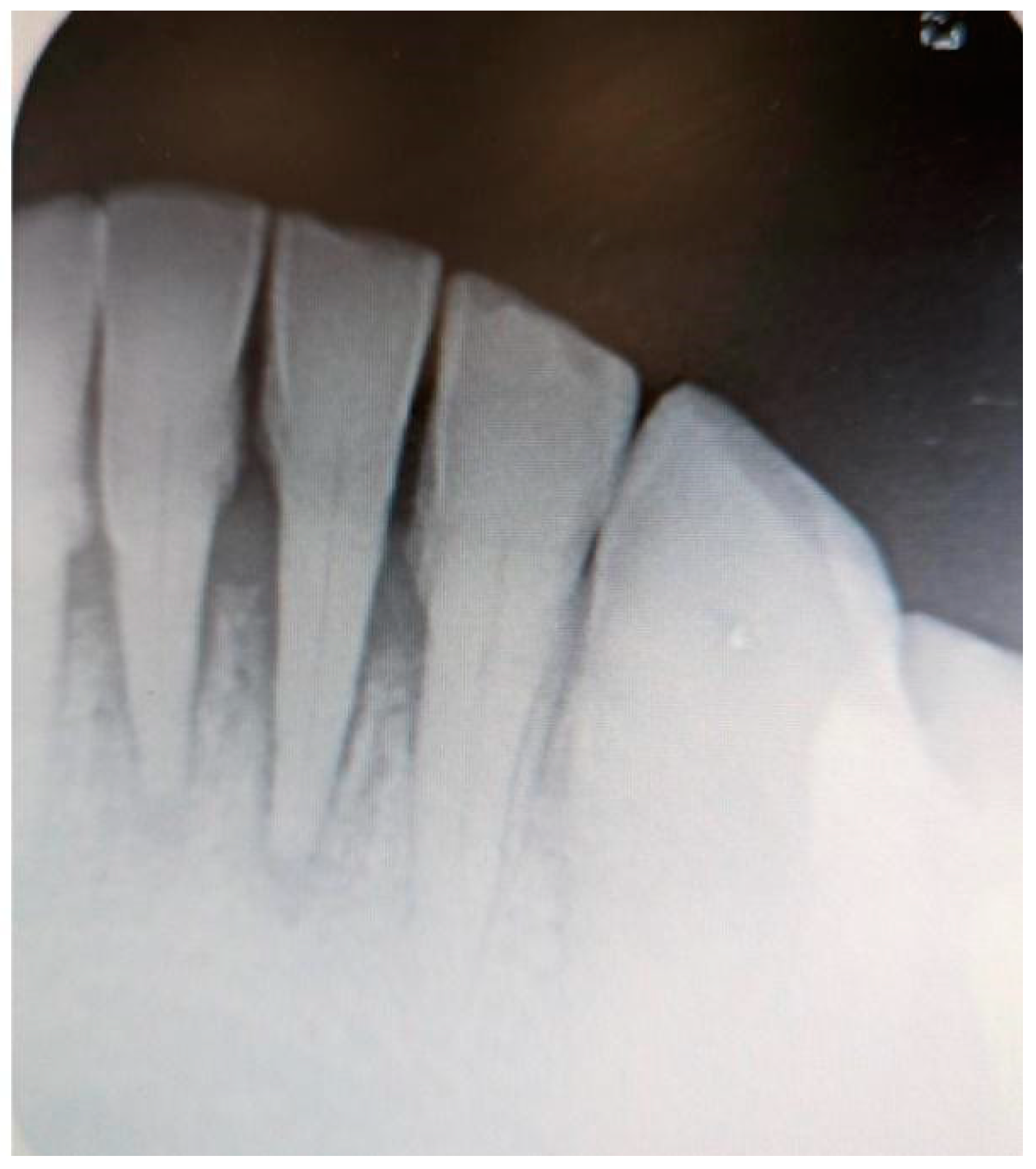 Medicina 61 00299 g004