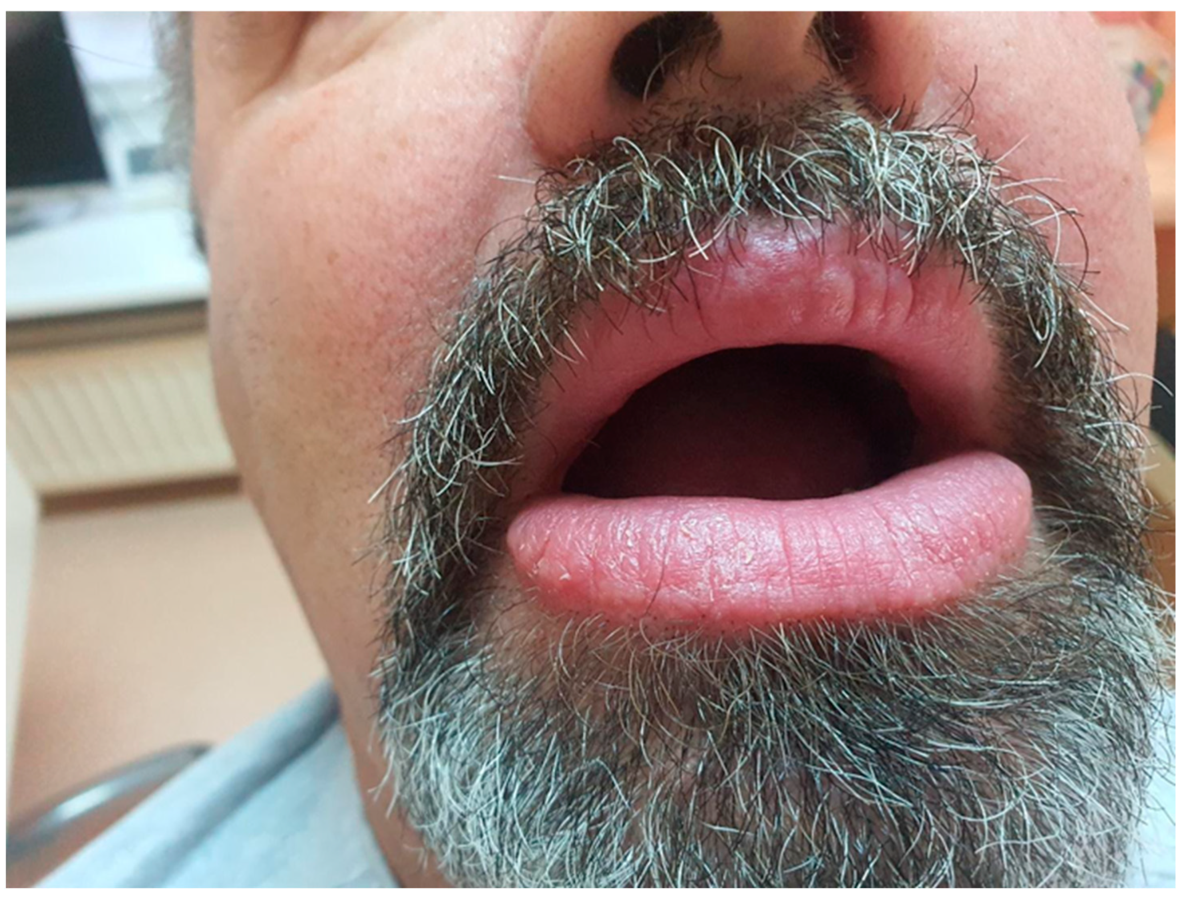 Medicina 61 00299 g006