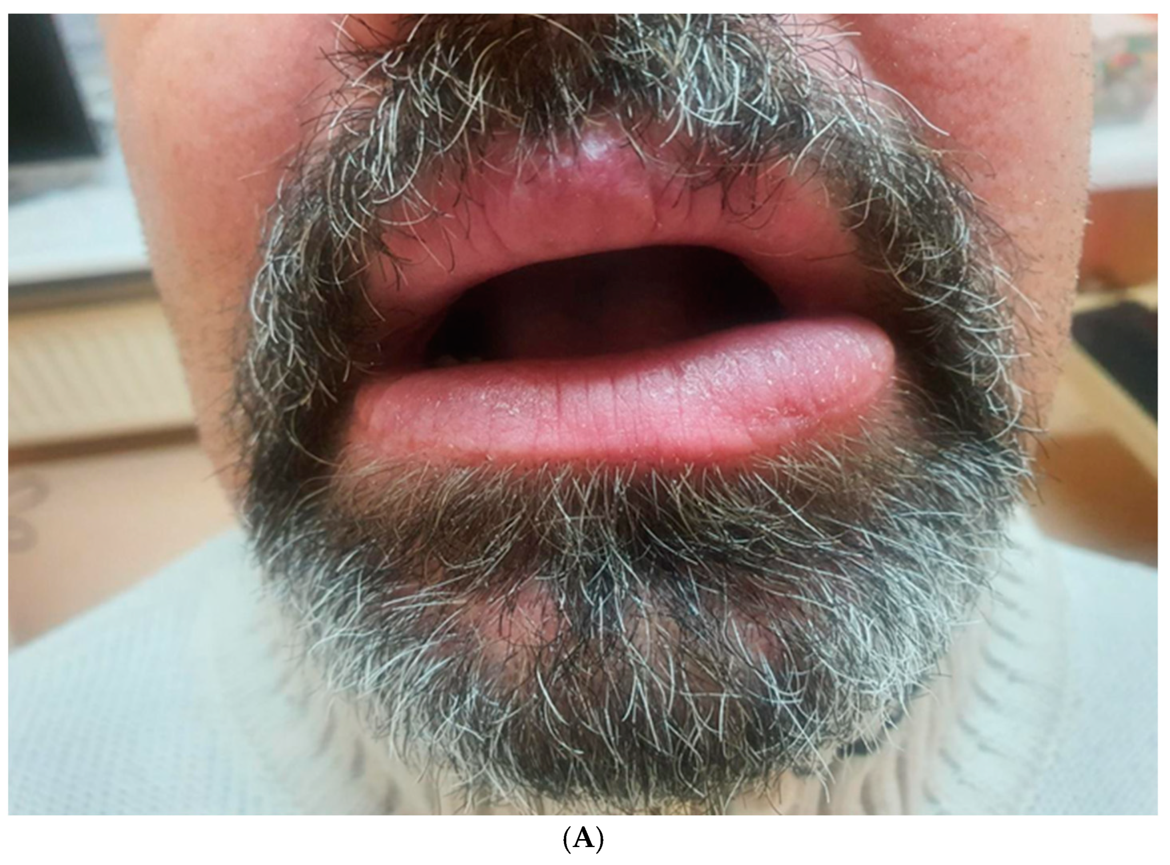 Medicina 61 00299 g007a