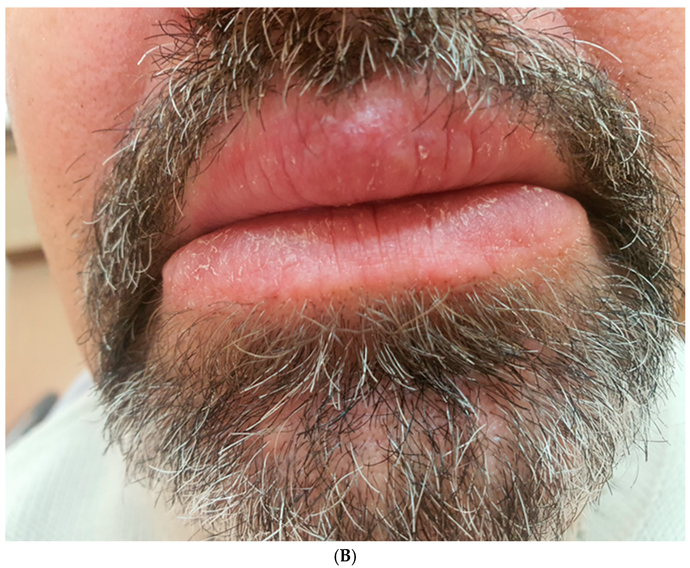 Medicina 61 00299 g007b