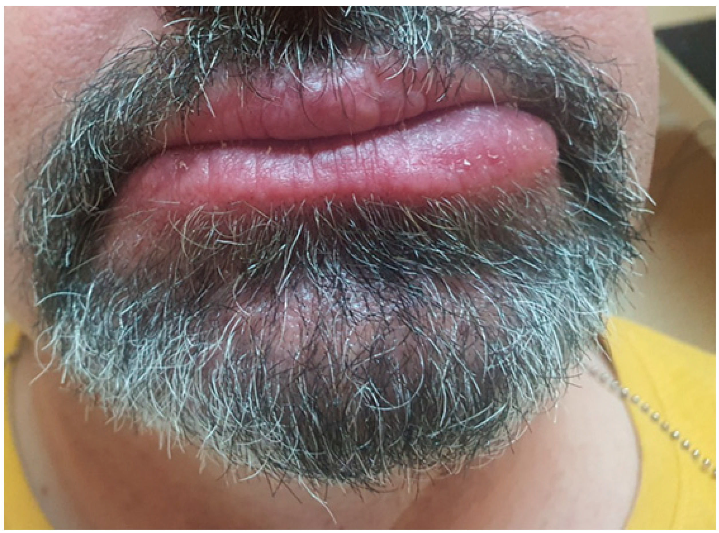 Medicina 61 00299 g008