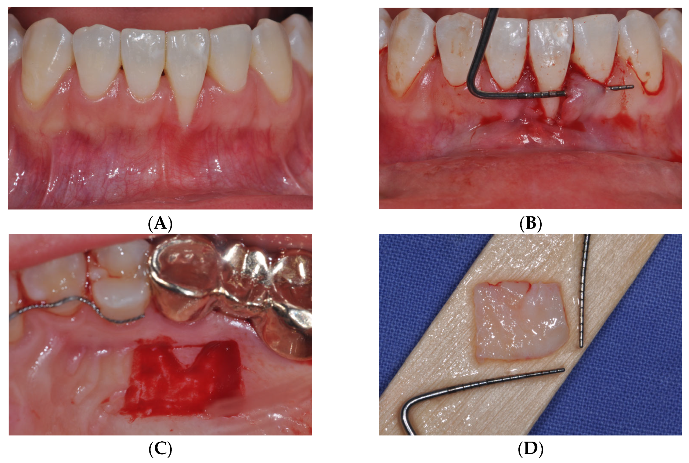 Medicina 61 00308 g001a