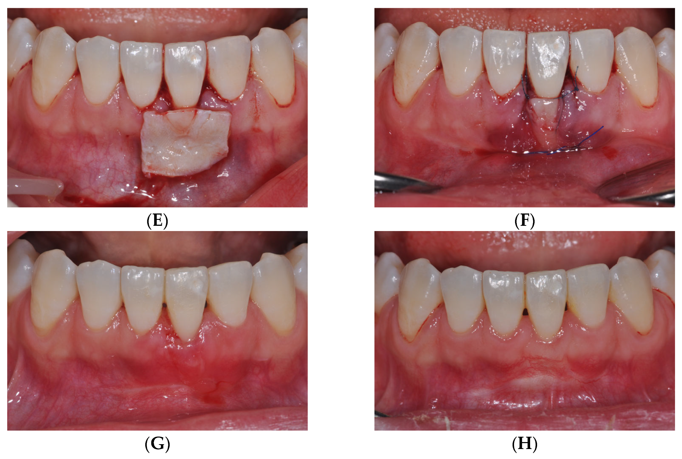 Medicina 61 00308 g001b