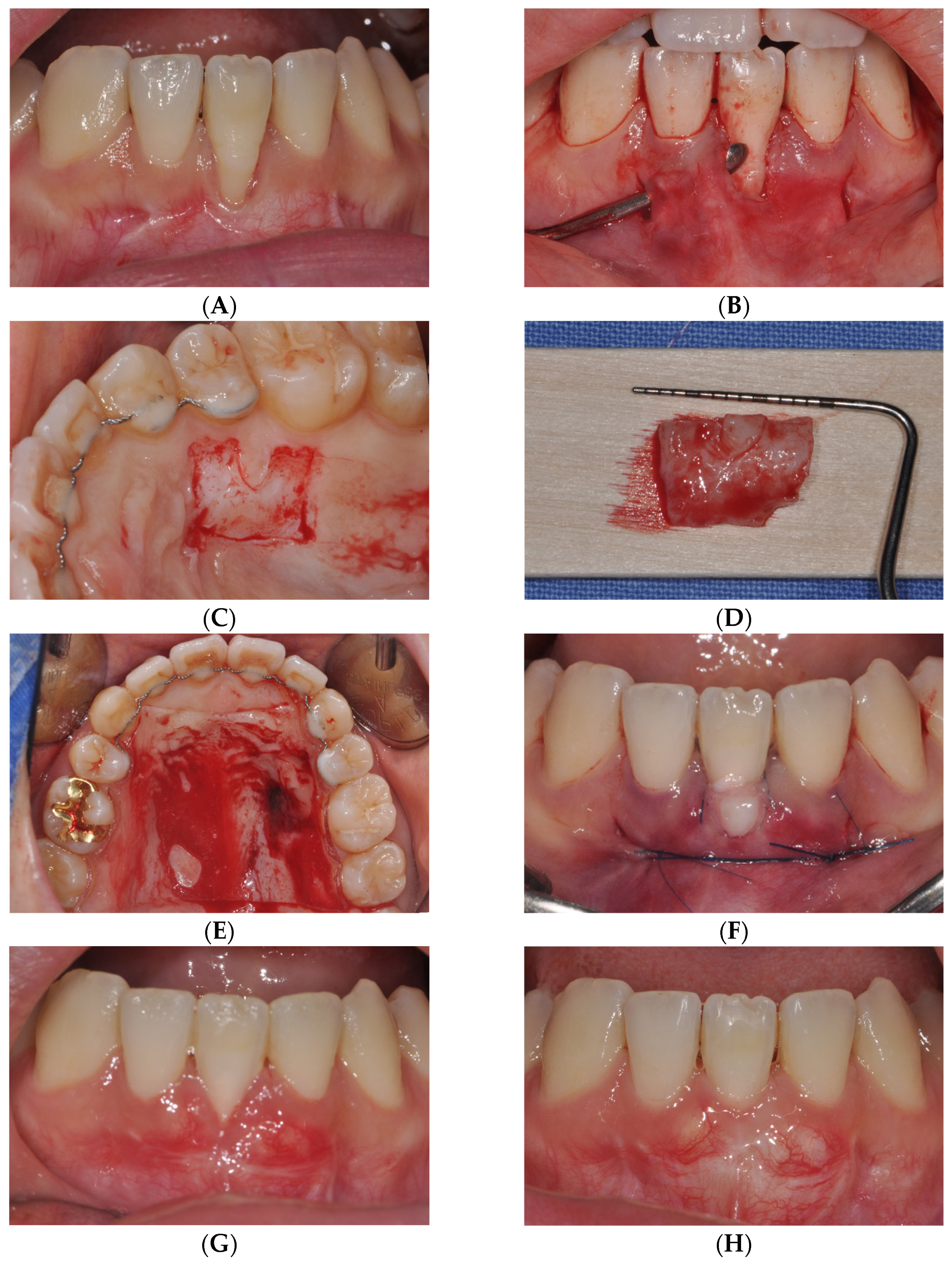 Medicina 61 00308 g002