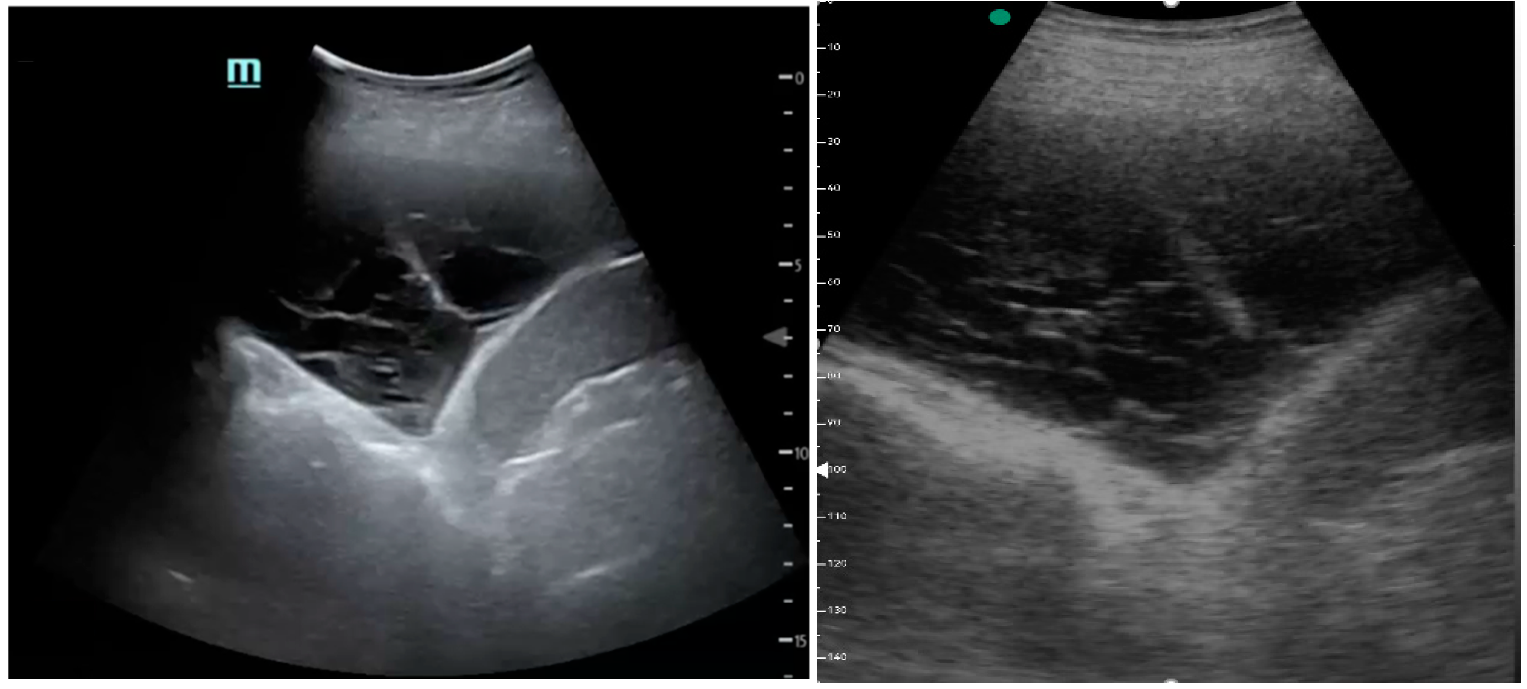 Medicina 61 00313 g002