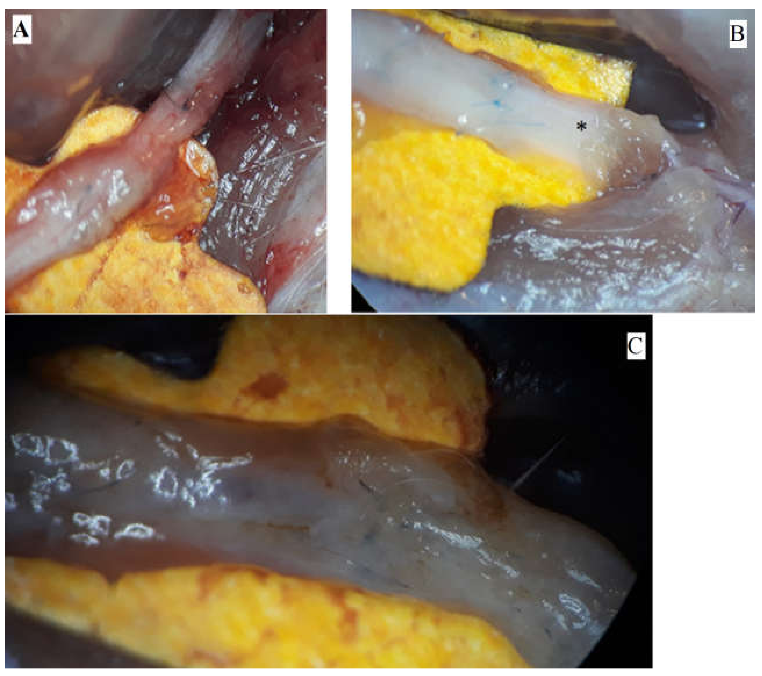 Medicina 61 00317 g001 Medicina 61 00317 g001