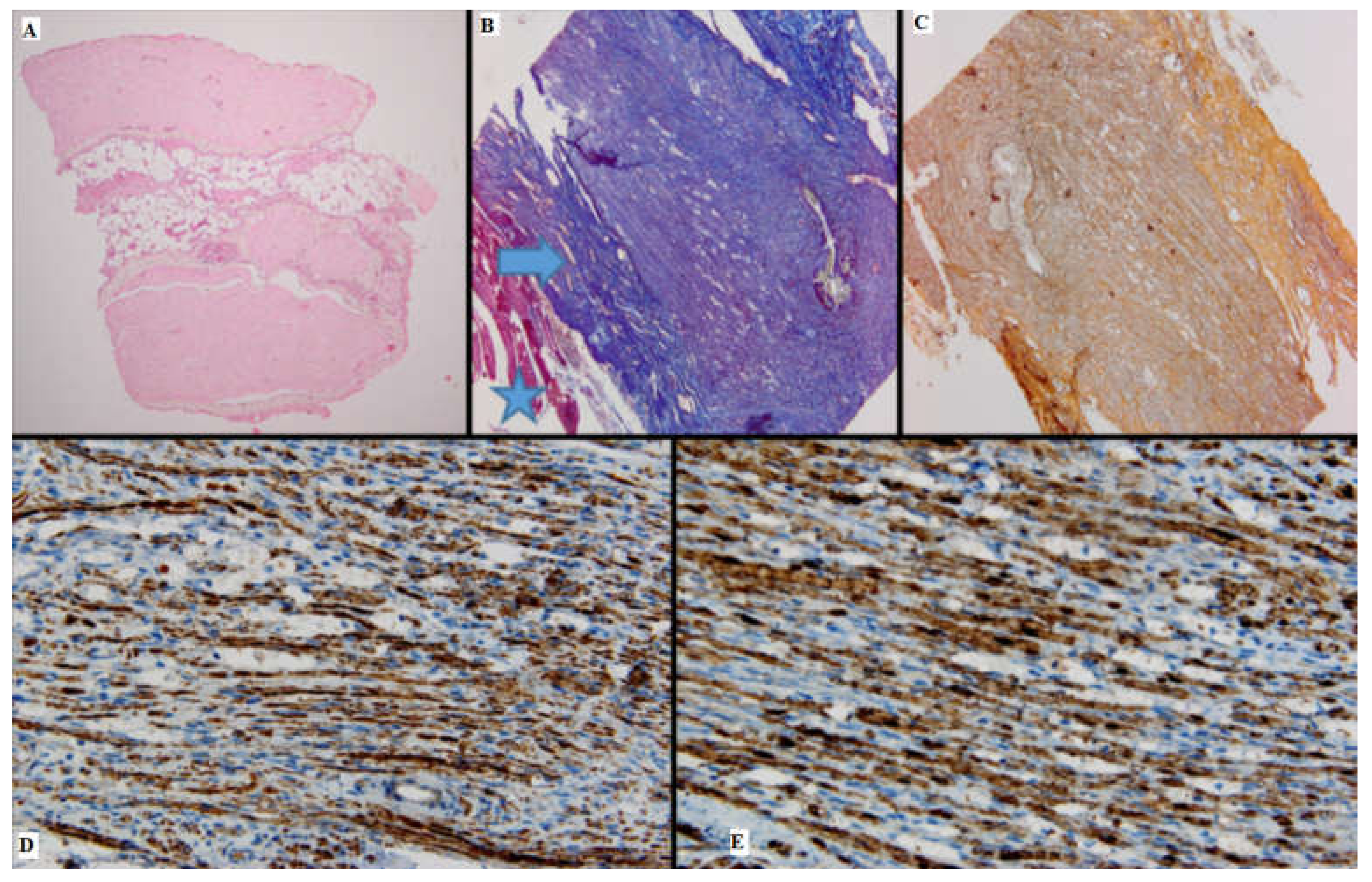 Medicina 61 00317 g002 Medicina 61 00317 g002
