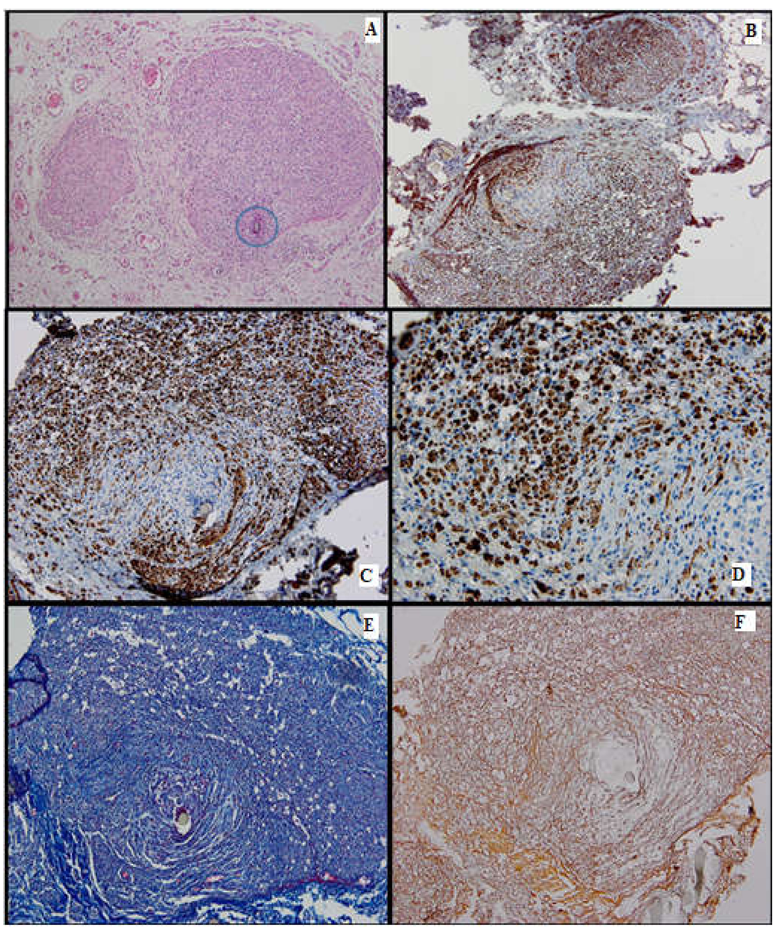 Medicina 61 00317 g003 Medicina 61 00317 g003