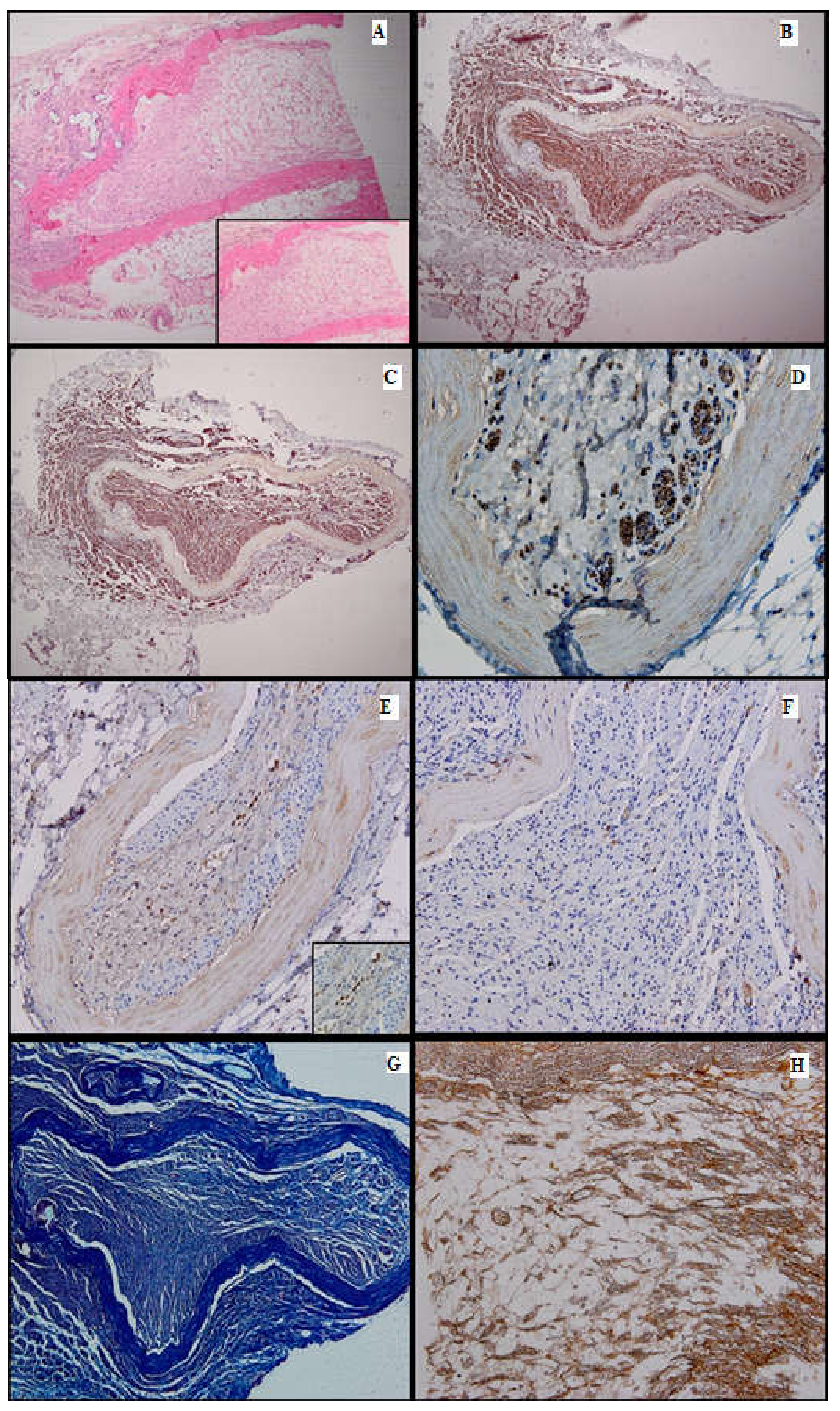 Medicina 61 00317 g006 Medicina 61 00317 g006
