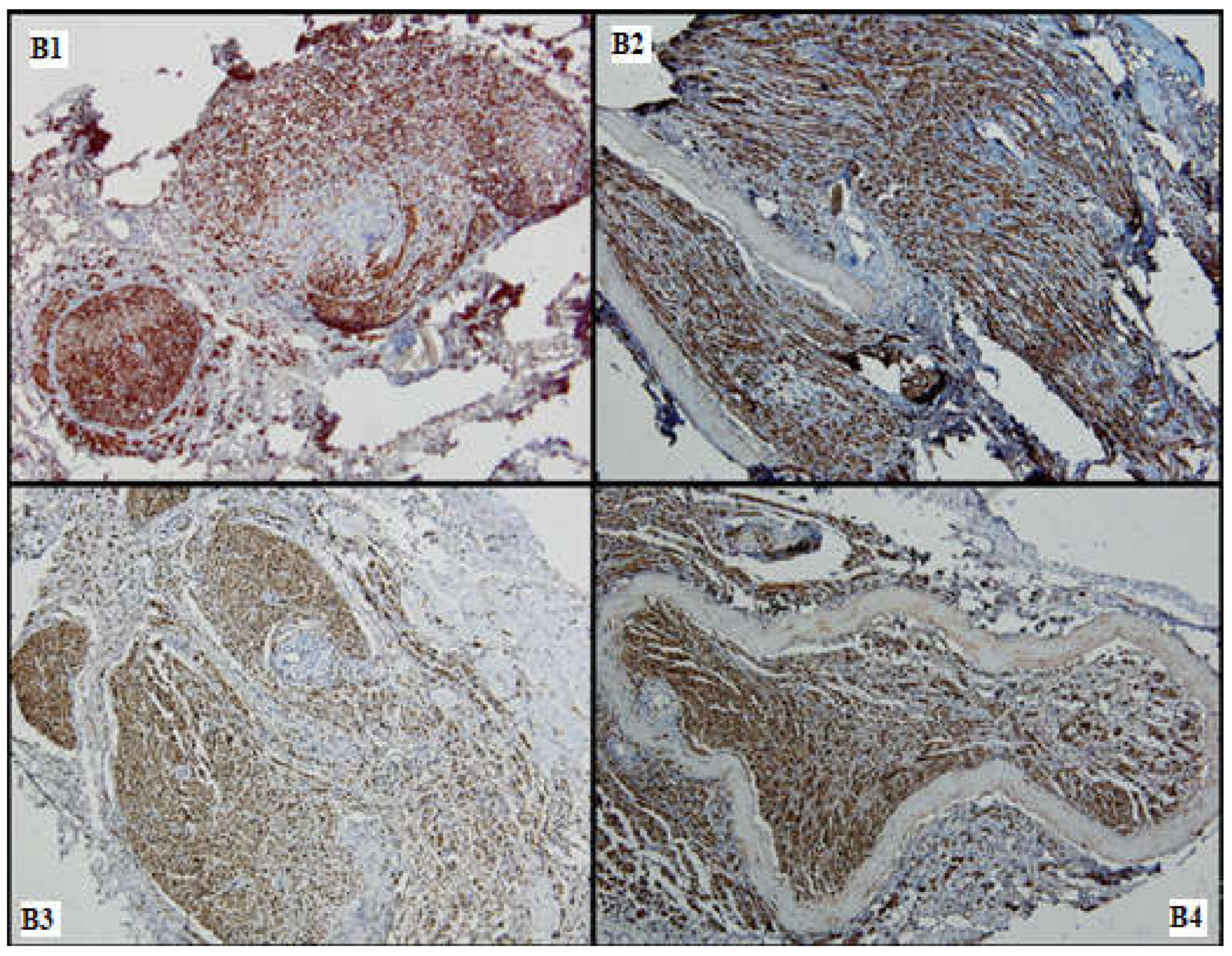 Medicina 61 00317 g007 Medicina 61 00317 g007