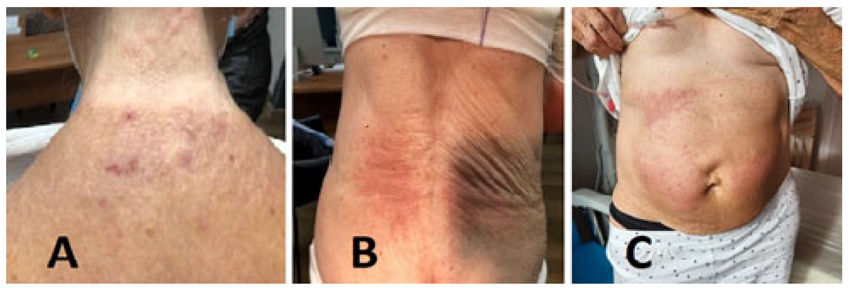 Medicina 61 00339 g001