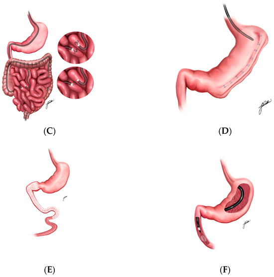 Medicina 61 00350 g002b