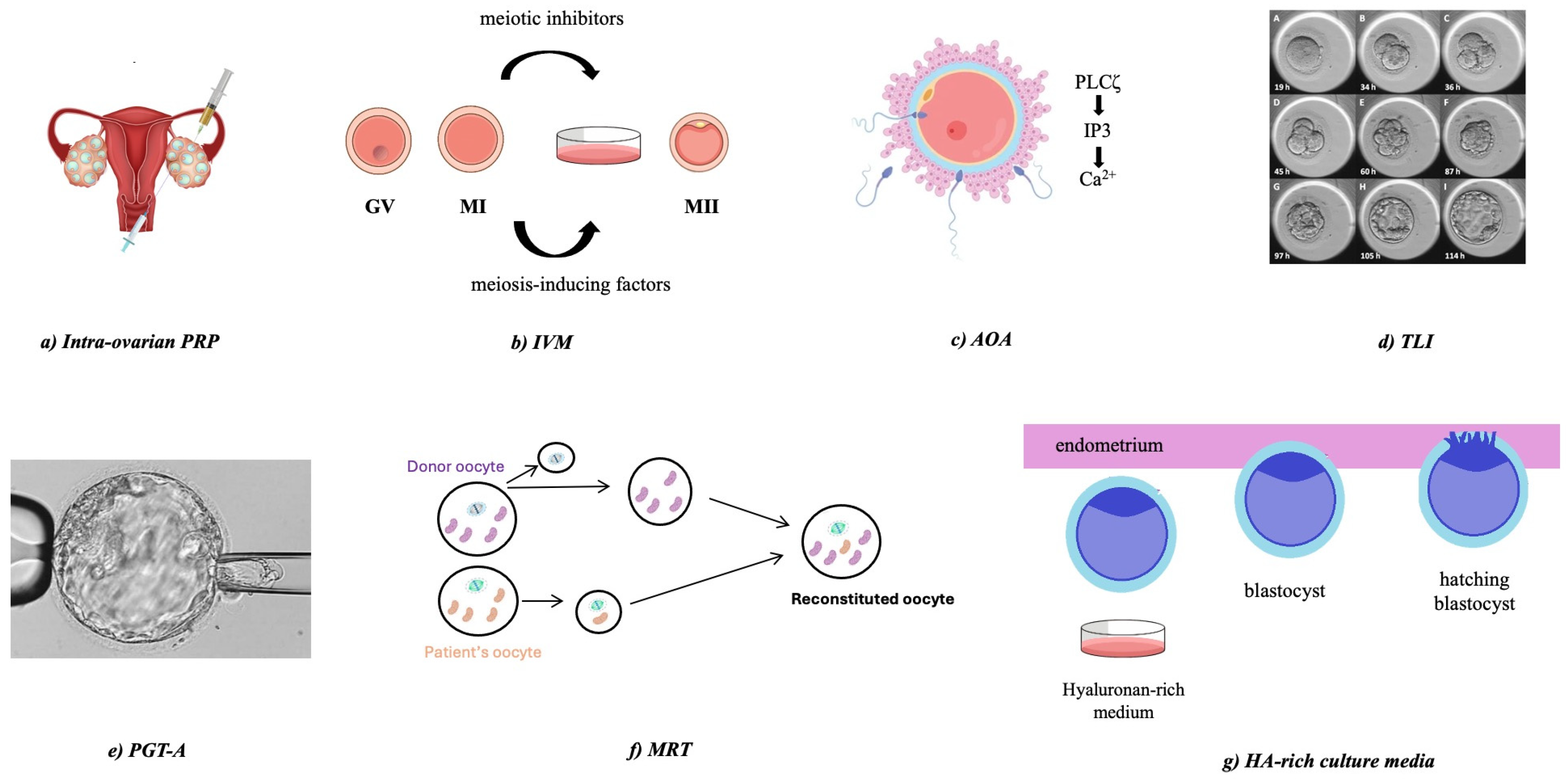 Medicina 61 00367 g001 Medicina 61 00367 g001