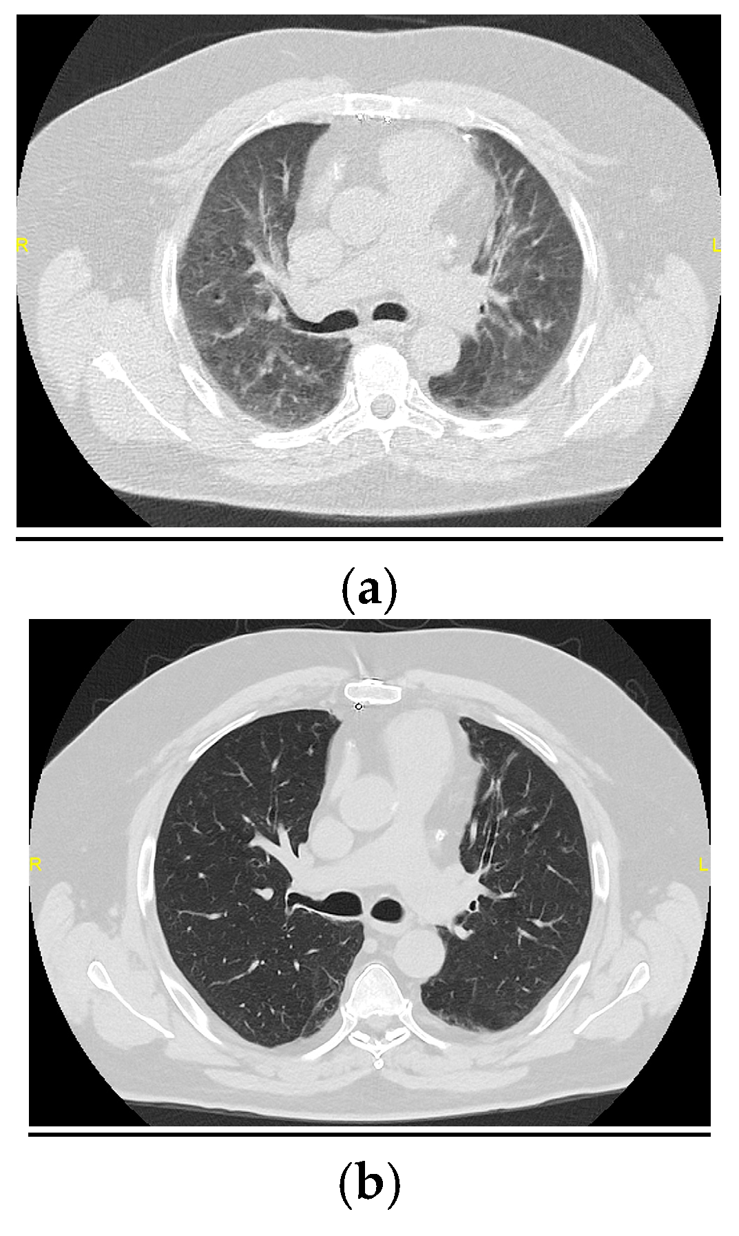 Medicina 61 00382 g001