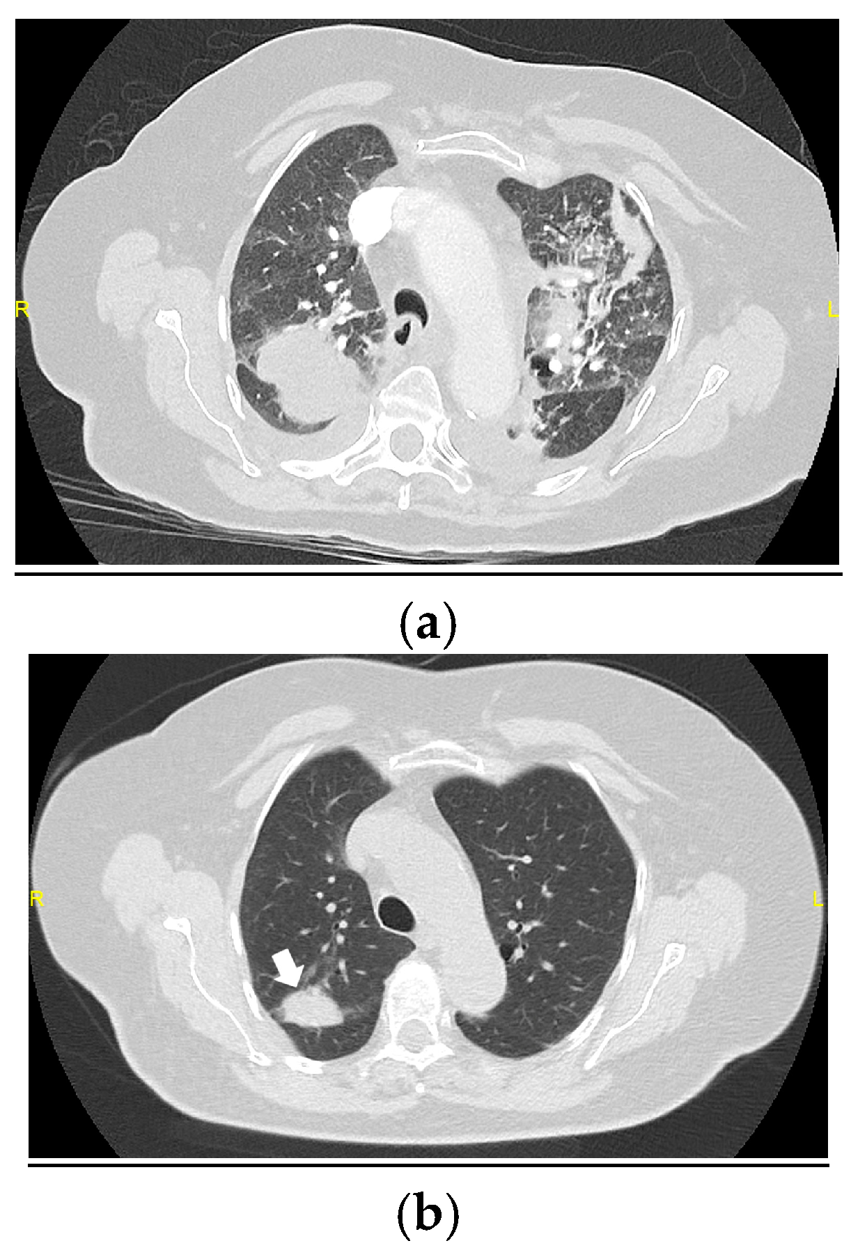Medicina 61 00382 g002