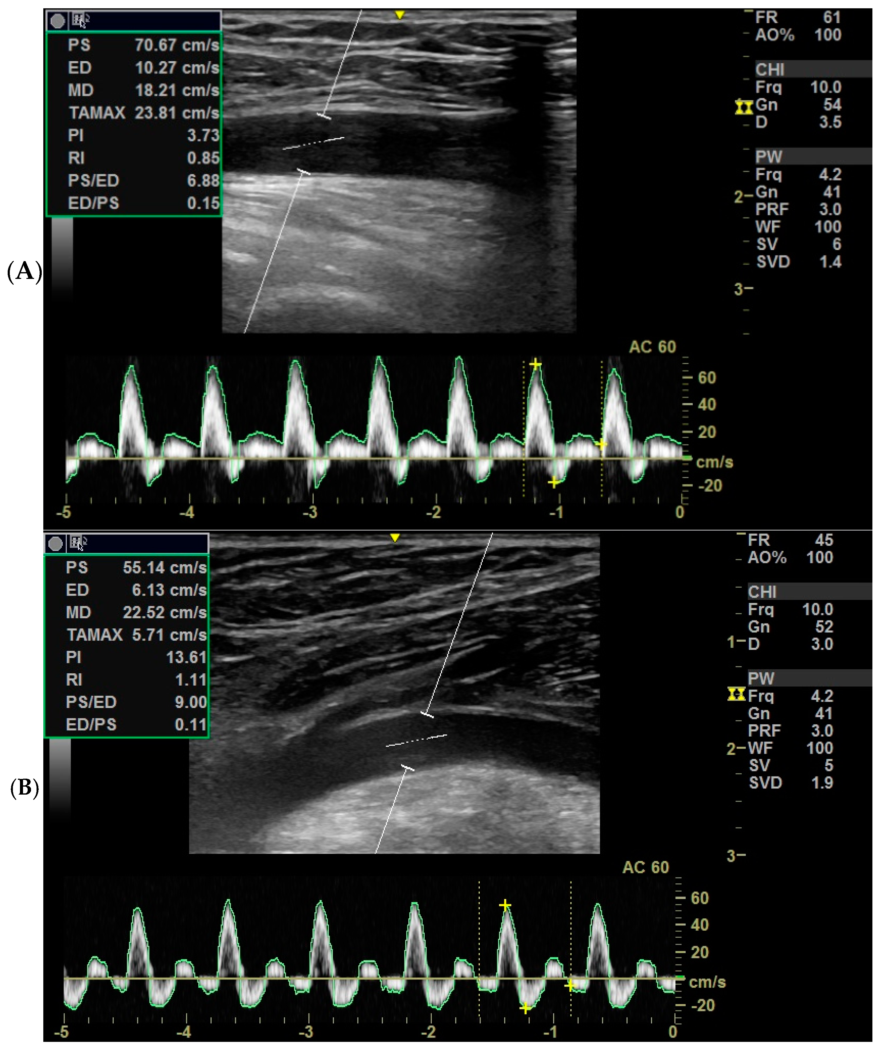 Medicina 61 00389 g001