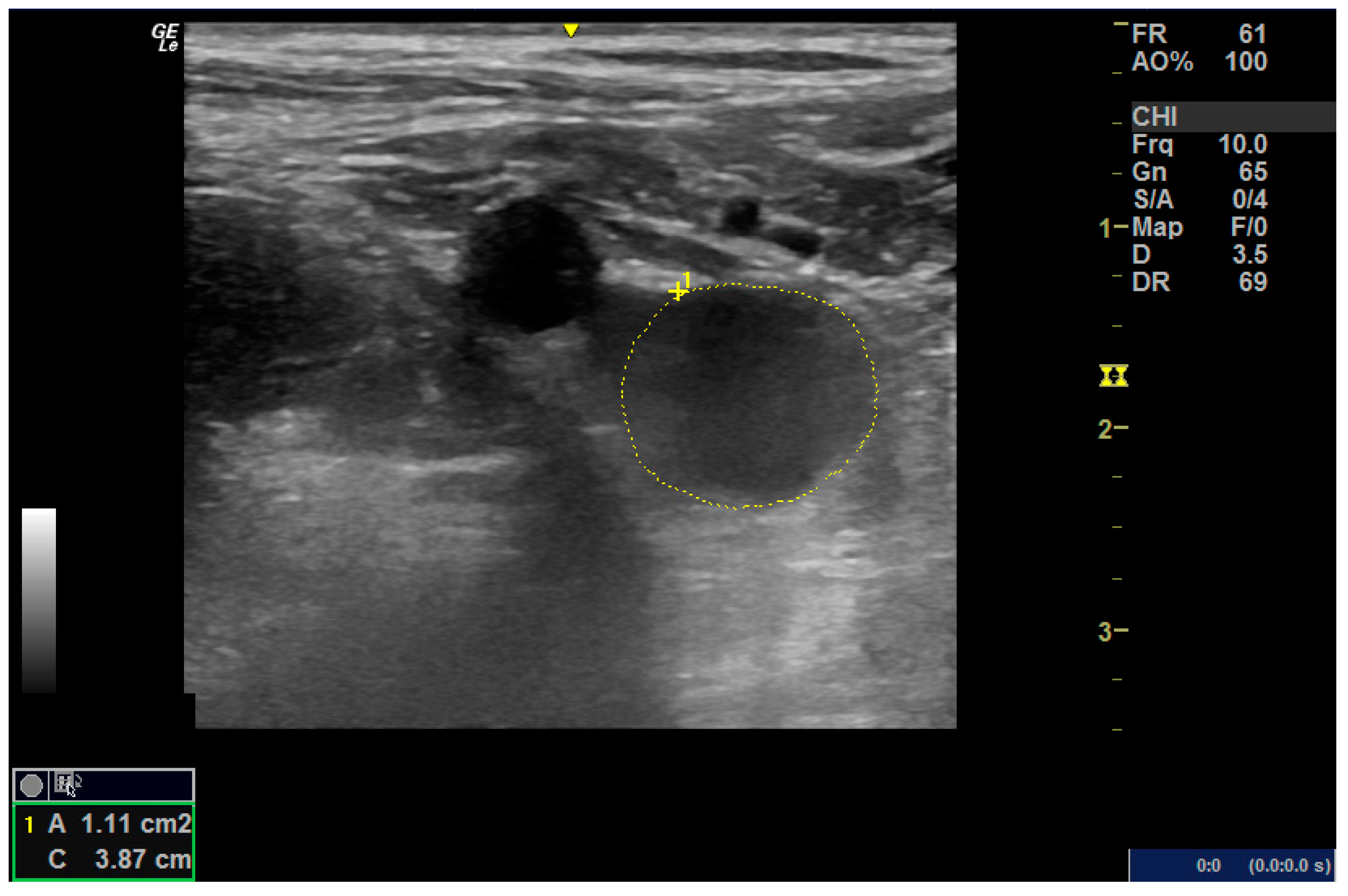 Medicina 61 00389 g002