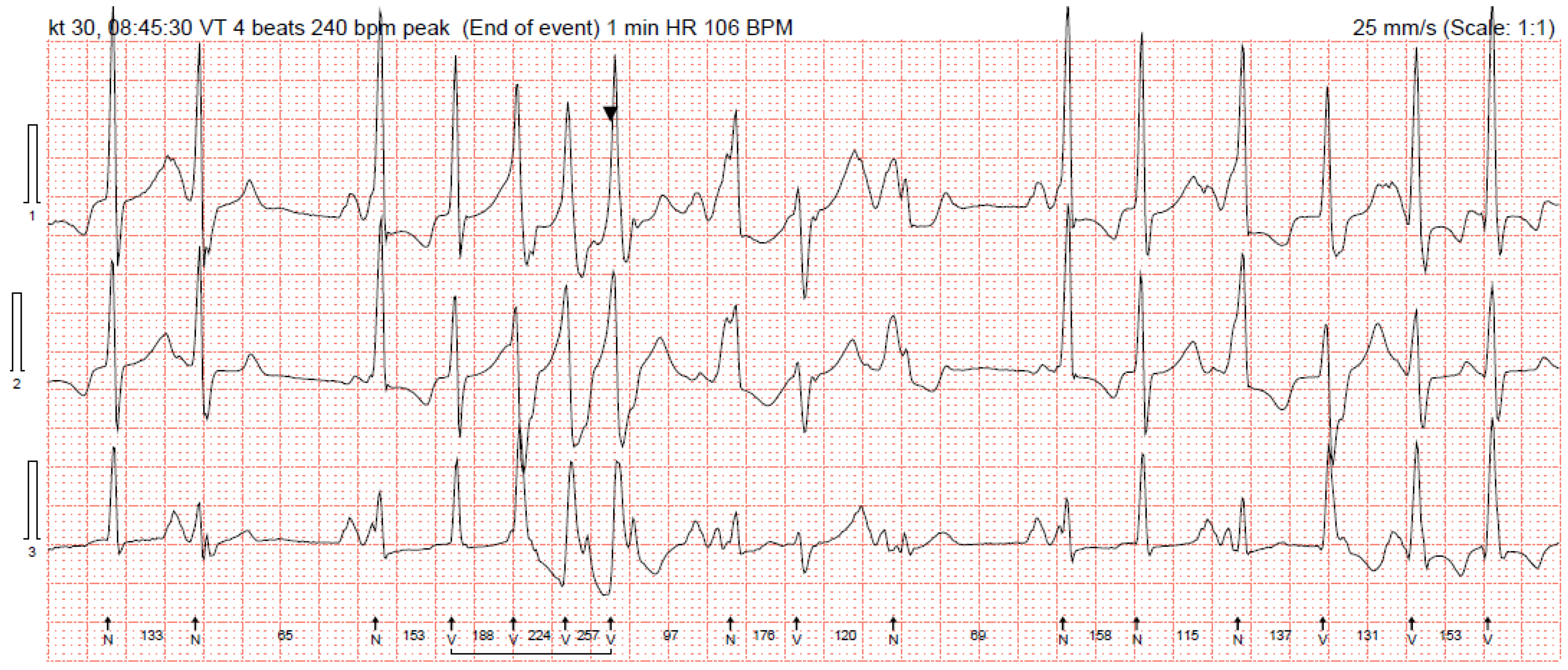 Medicina 61 00393 g002
