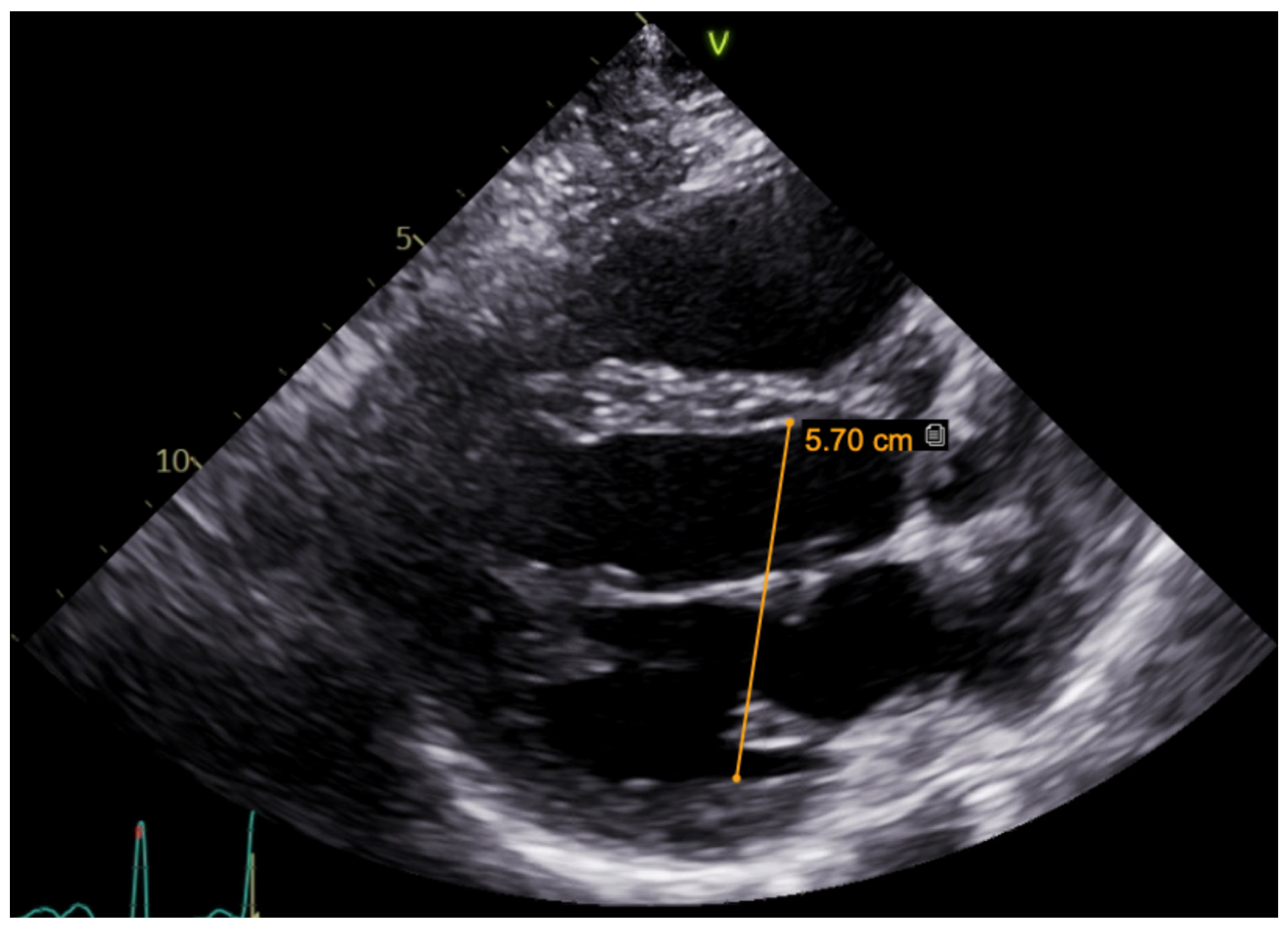 Medicina 61 00393 g003